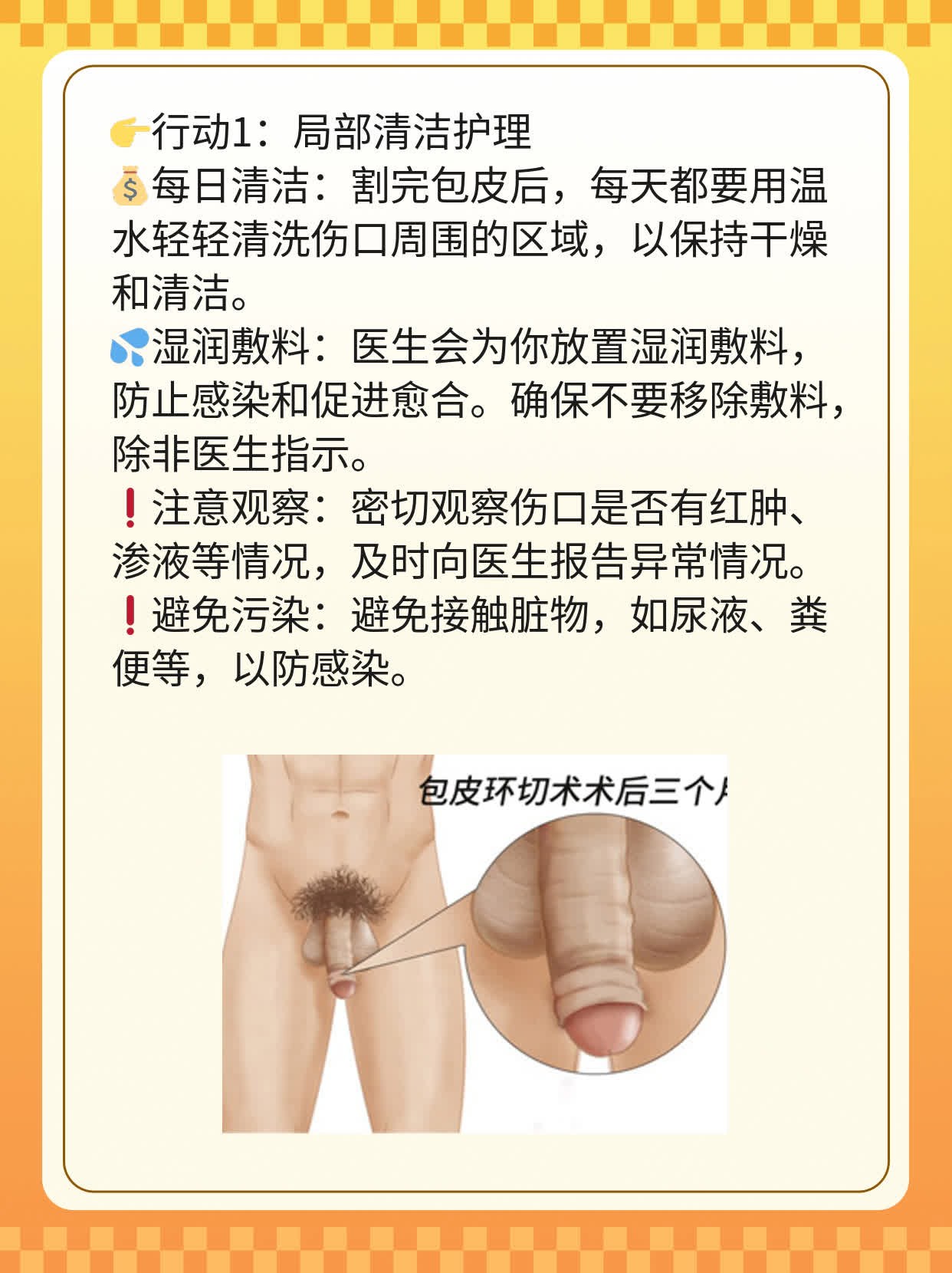 🥩「揭秘」割包皮：男人必做的决定？🌟
