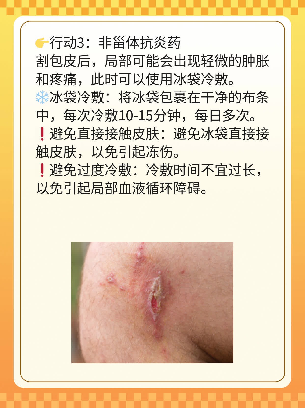 🥩「揭秘」割包皮：男人必做的决定？🌟