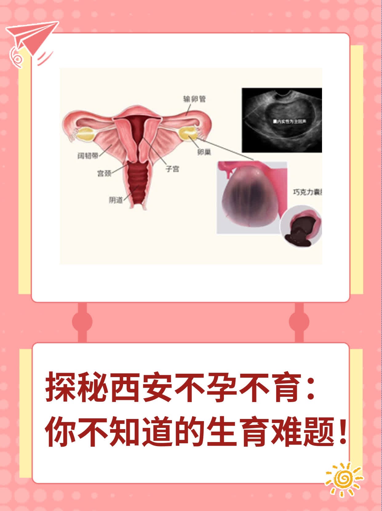 📈探秘西安不孕不育：你不知道的生育难题！🥊