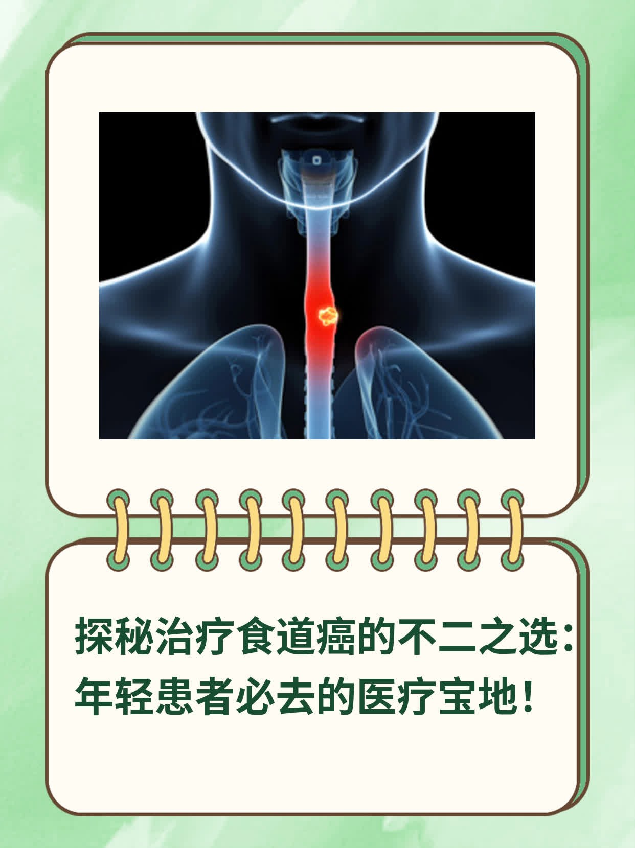 🛏️探秘治疗食道癌的不二之选：年轻患者必去的医疗宝地！💧