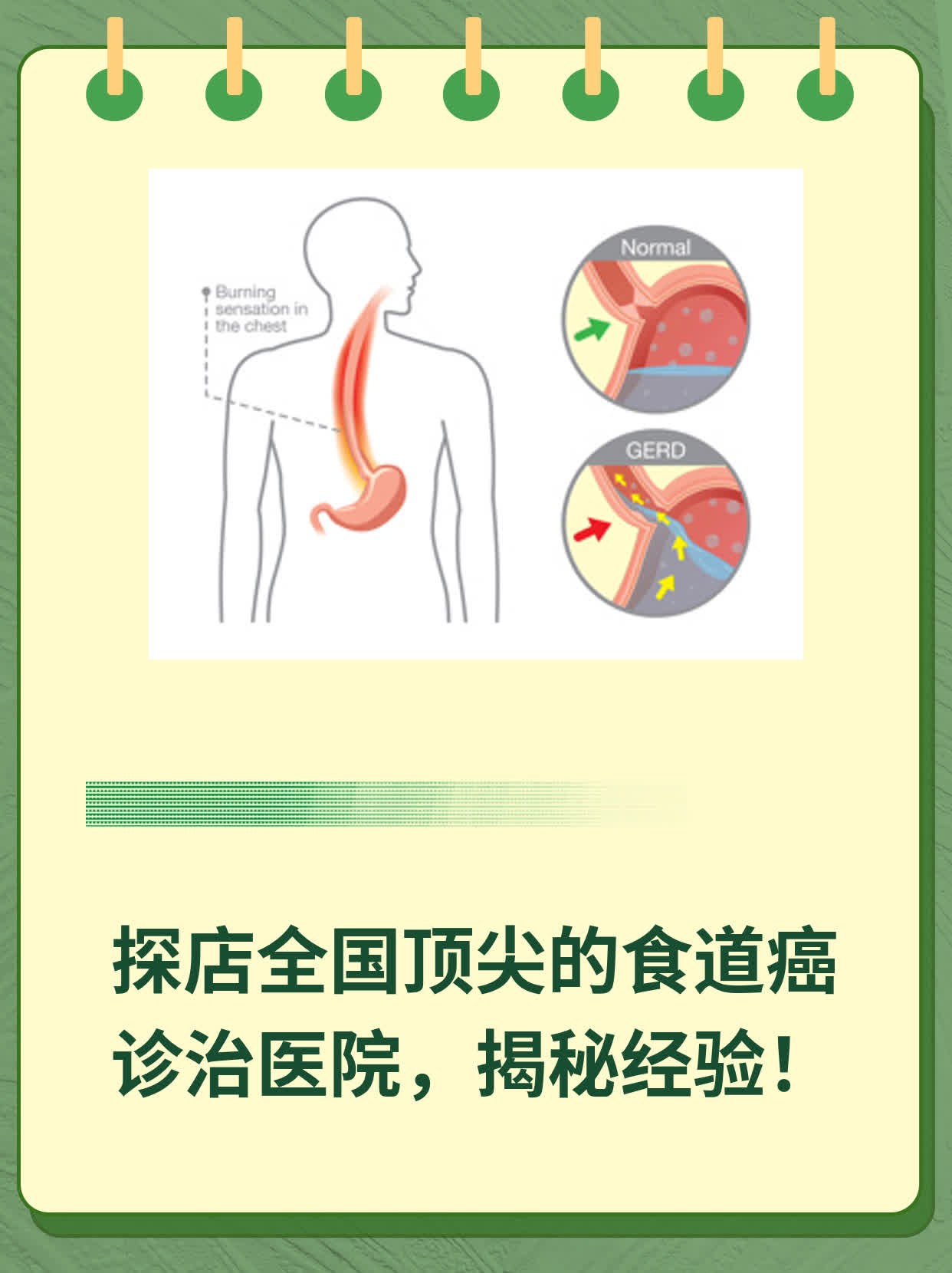 🌟探店全国顶尖的食道癌诊治医院，揭秘经验！✨