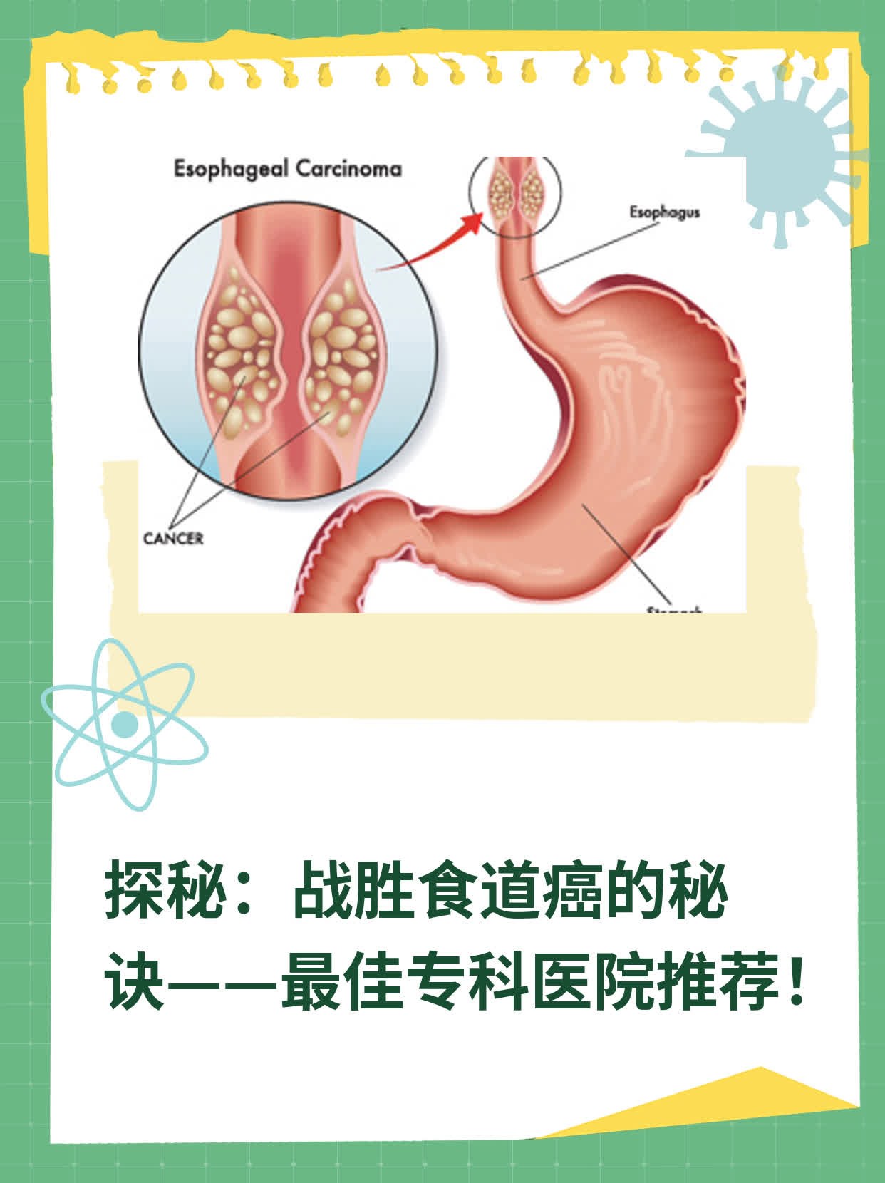 🛏️探秘：战胜食道癌的秘诀——最佳专科医院推荐！💧