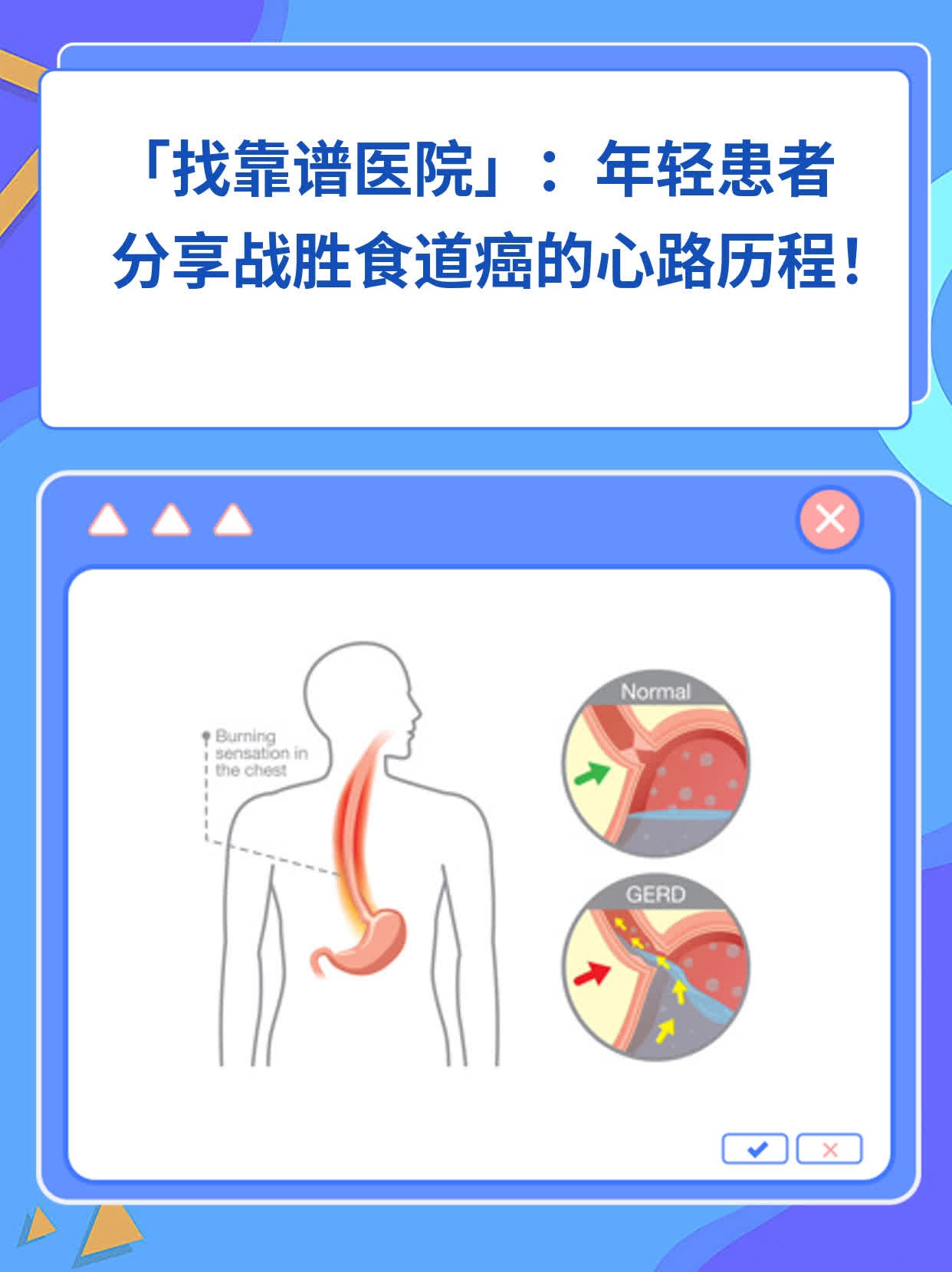 🌟「找靠谱医院」：年轻患者分享战胜食道癌的心路历程！✨