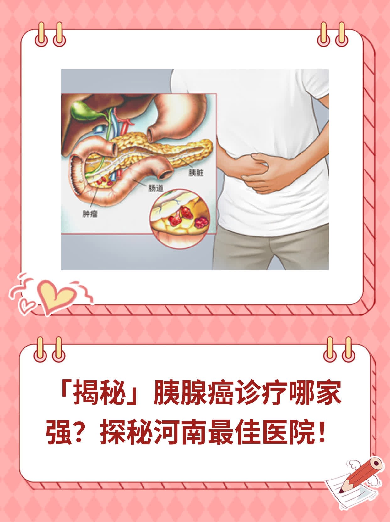 🥊「揭秘」胰腺癌诊疗哪家强？探秘河南最佳医院！🥩