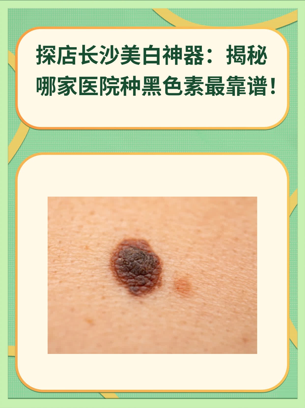 🏃探店长沙美白神器：揭秘哪家医院种黑色素最靠谱！❗️