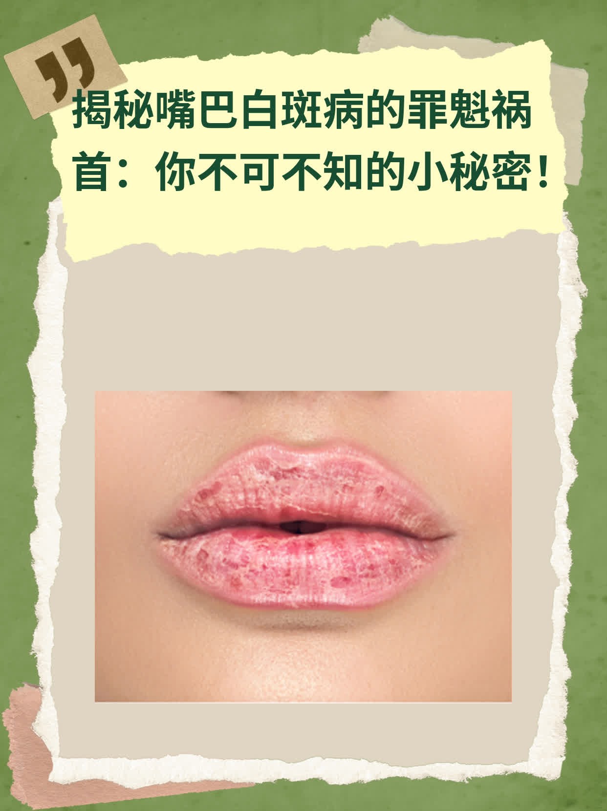 👍揭秘嘴巴白斑病的罪魁祸首：你不可不知的小秘密！🛏️