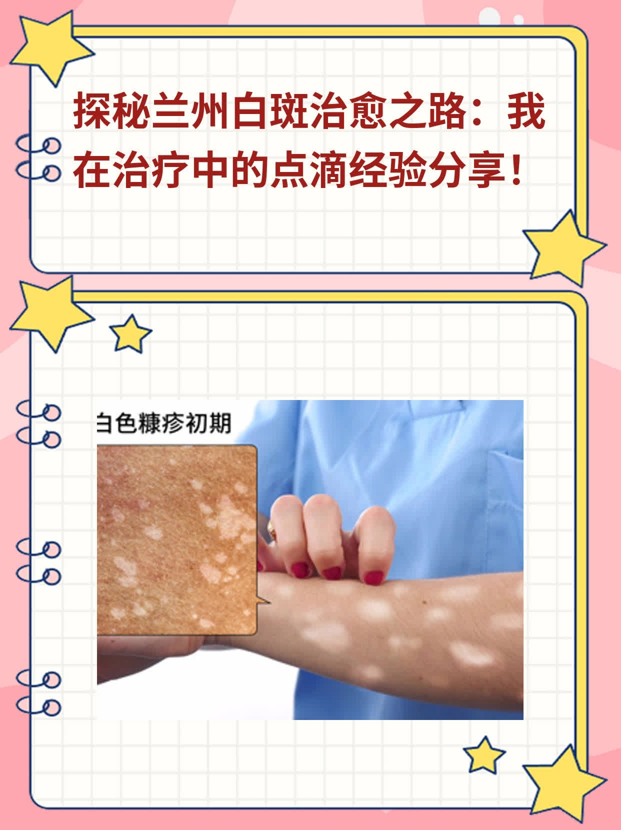 💖探秘兰州白斑治愈之路：我在治疗中的点滴经验分享！📈