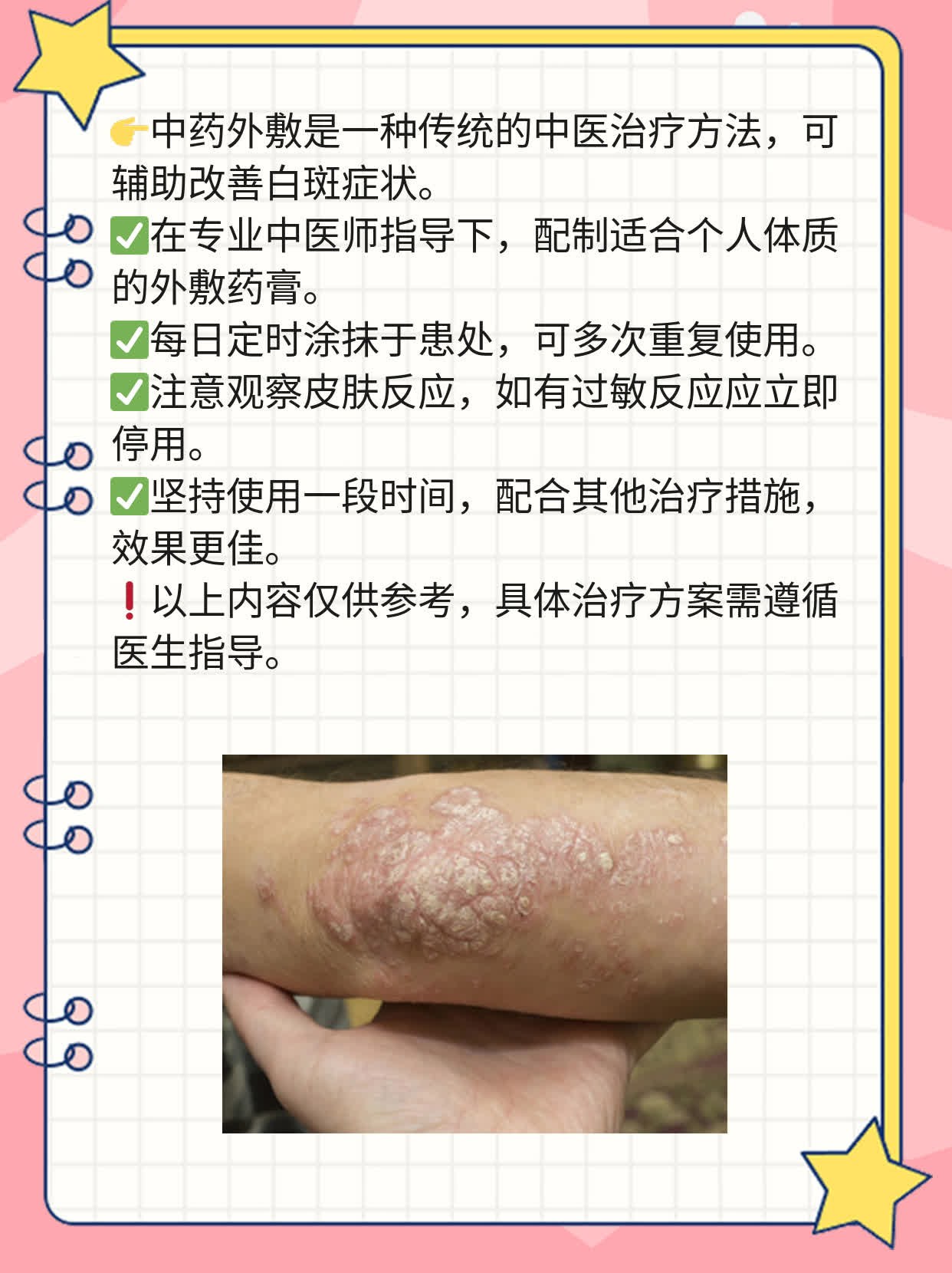 💖探秘兰州白斑治愈之路：我在治疗中的点滴经验分享！📈