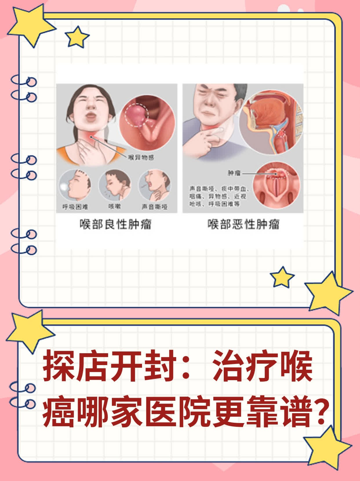 💖探店开封：治疗喉癌哪家医院更靠谱？📈