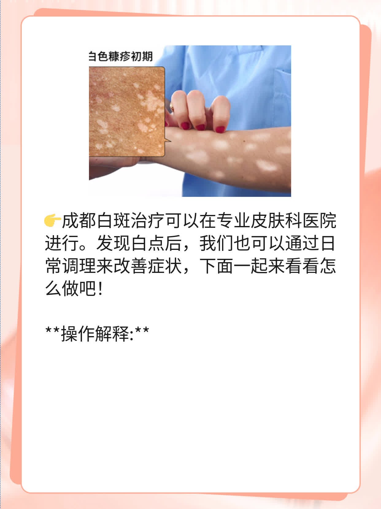 📈「揭秘」成都白斑治疗攻略：发现白点也能变美！🥊