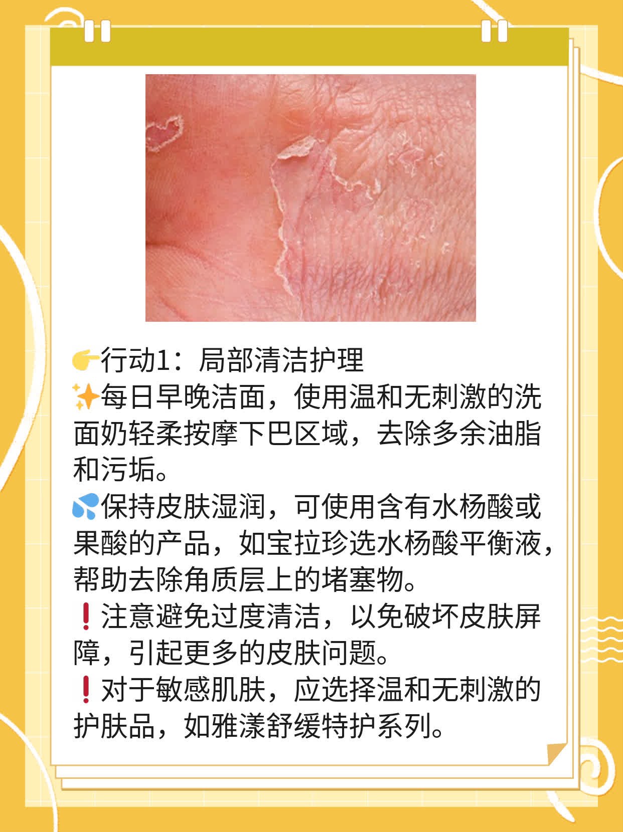 🥩揭秘：搞定下巴小白点的神奇妙招！🌟