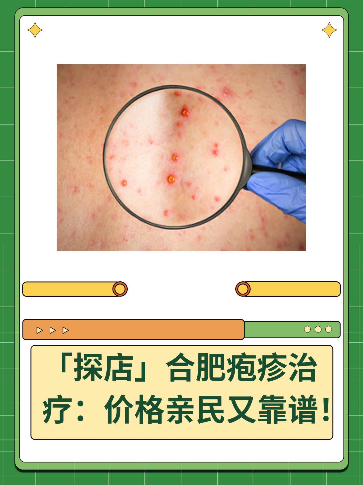 💧「探店」合肥疱疹治疗：价格亲民又靠谱！🥦