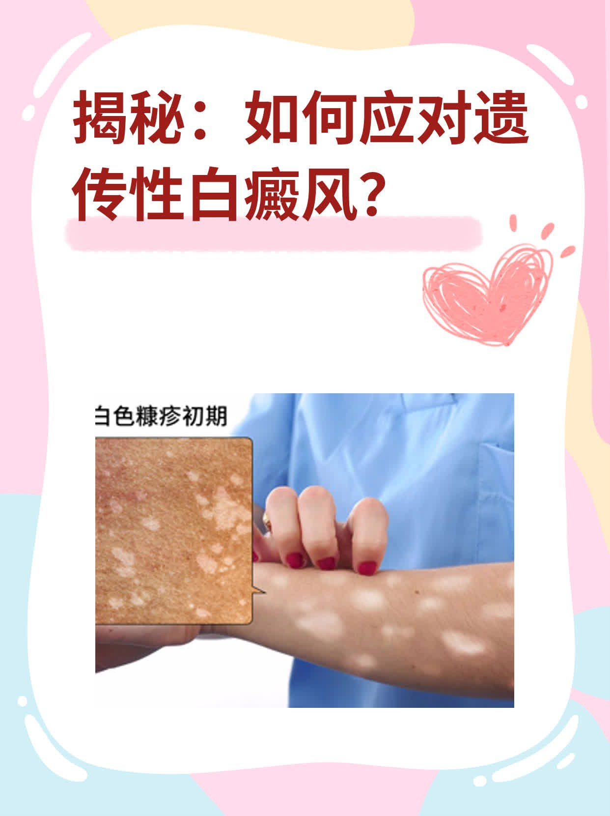 💖揭秘：如何应对遗传性白癜风？📈