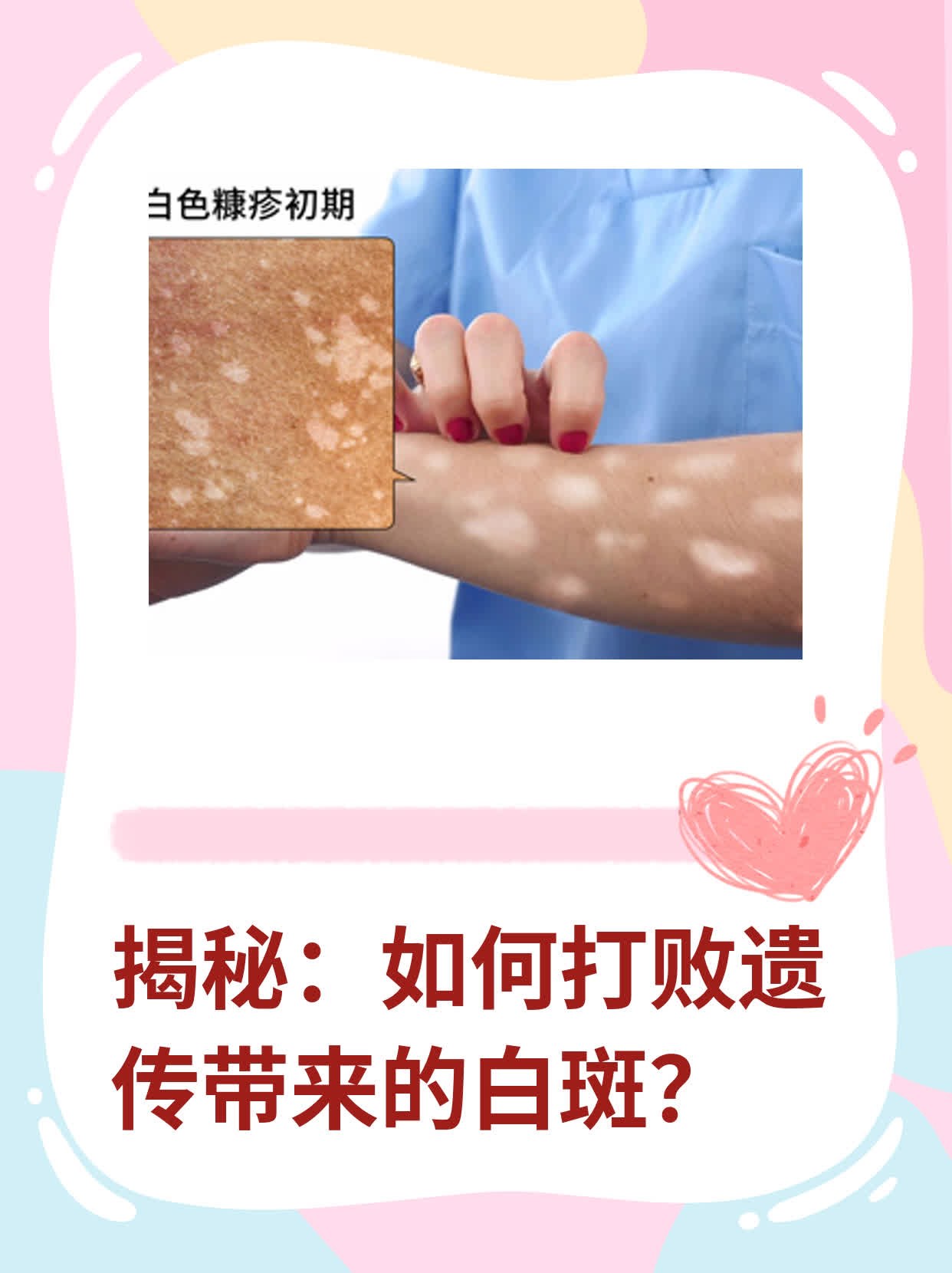 🛏️揭秘：如何打败遗传带来的白斑？💧