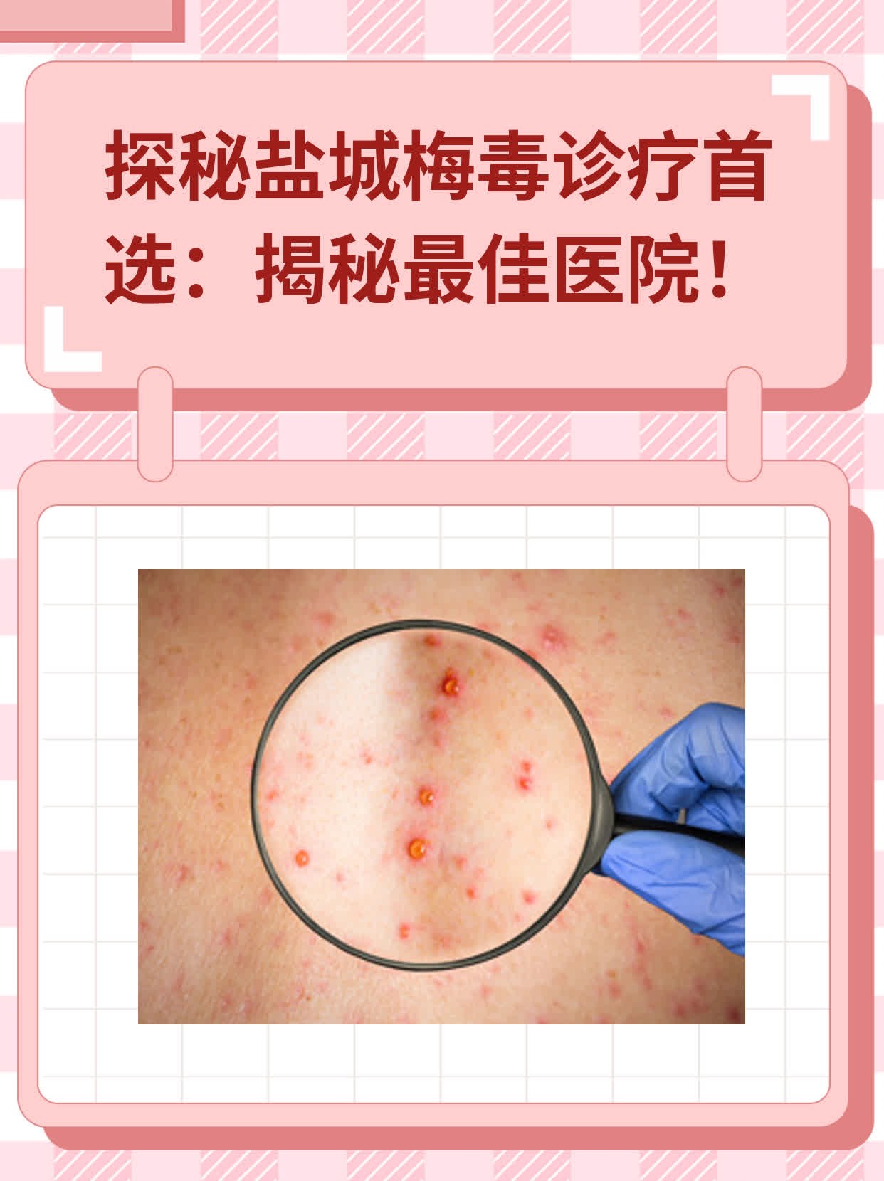 💖探秘盐城梅毒诊疗首选：揭秘最佳医院！📈