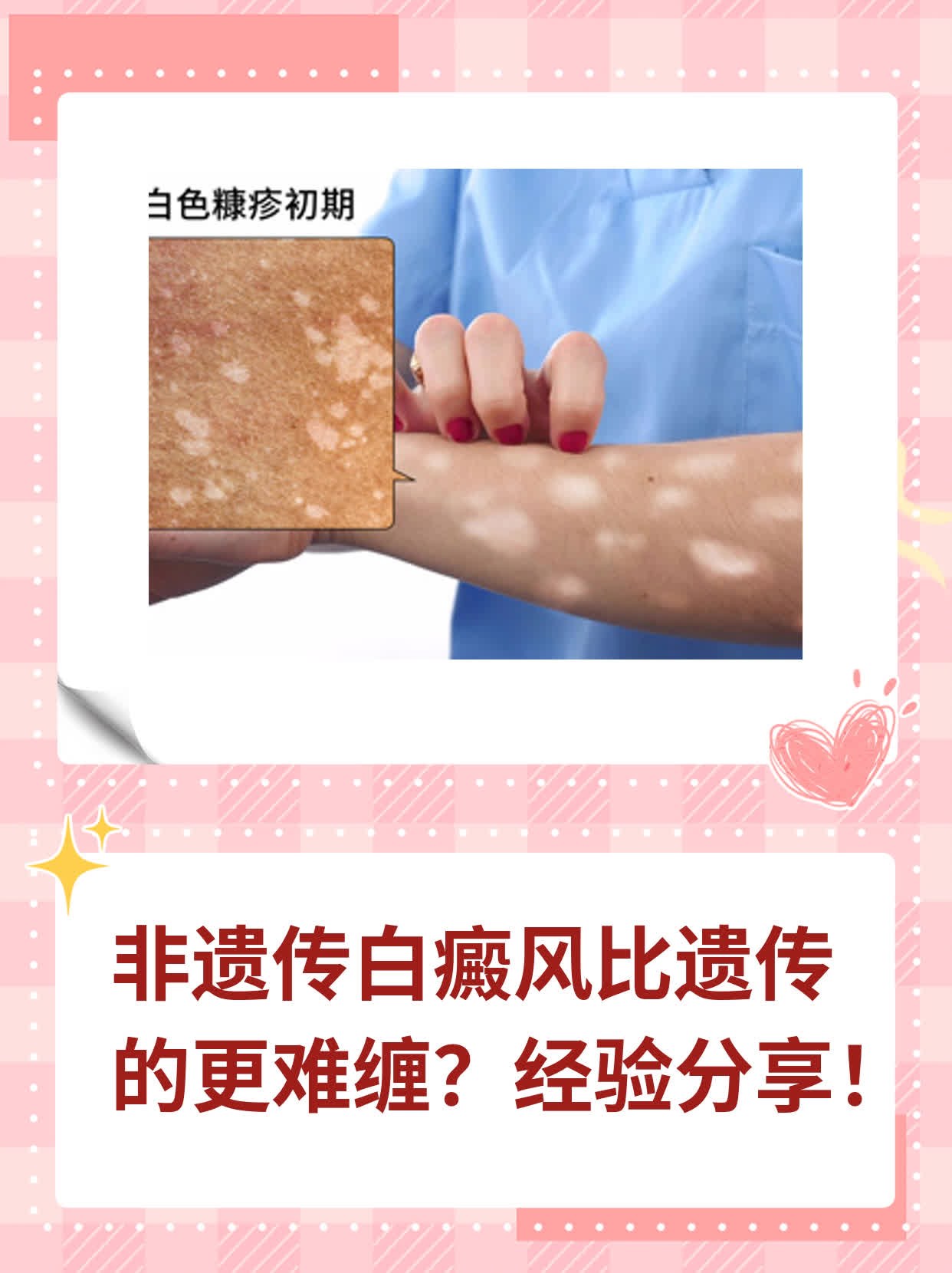 🙏非遗传白癜风比遗传的更难缠？经验分享！💊