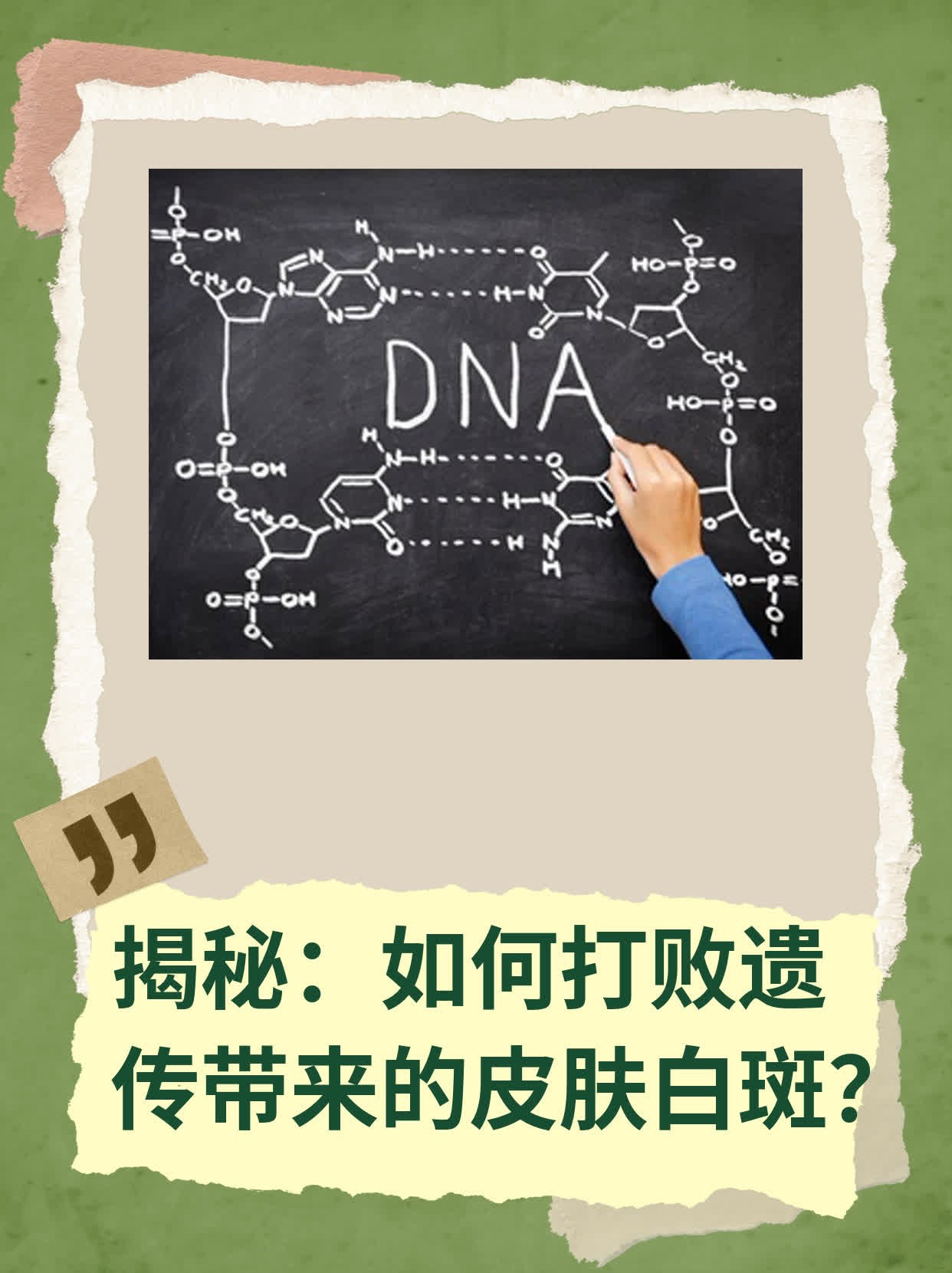 💊揭秘：如何打败遗传带来的皮肤白斑？👍