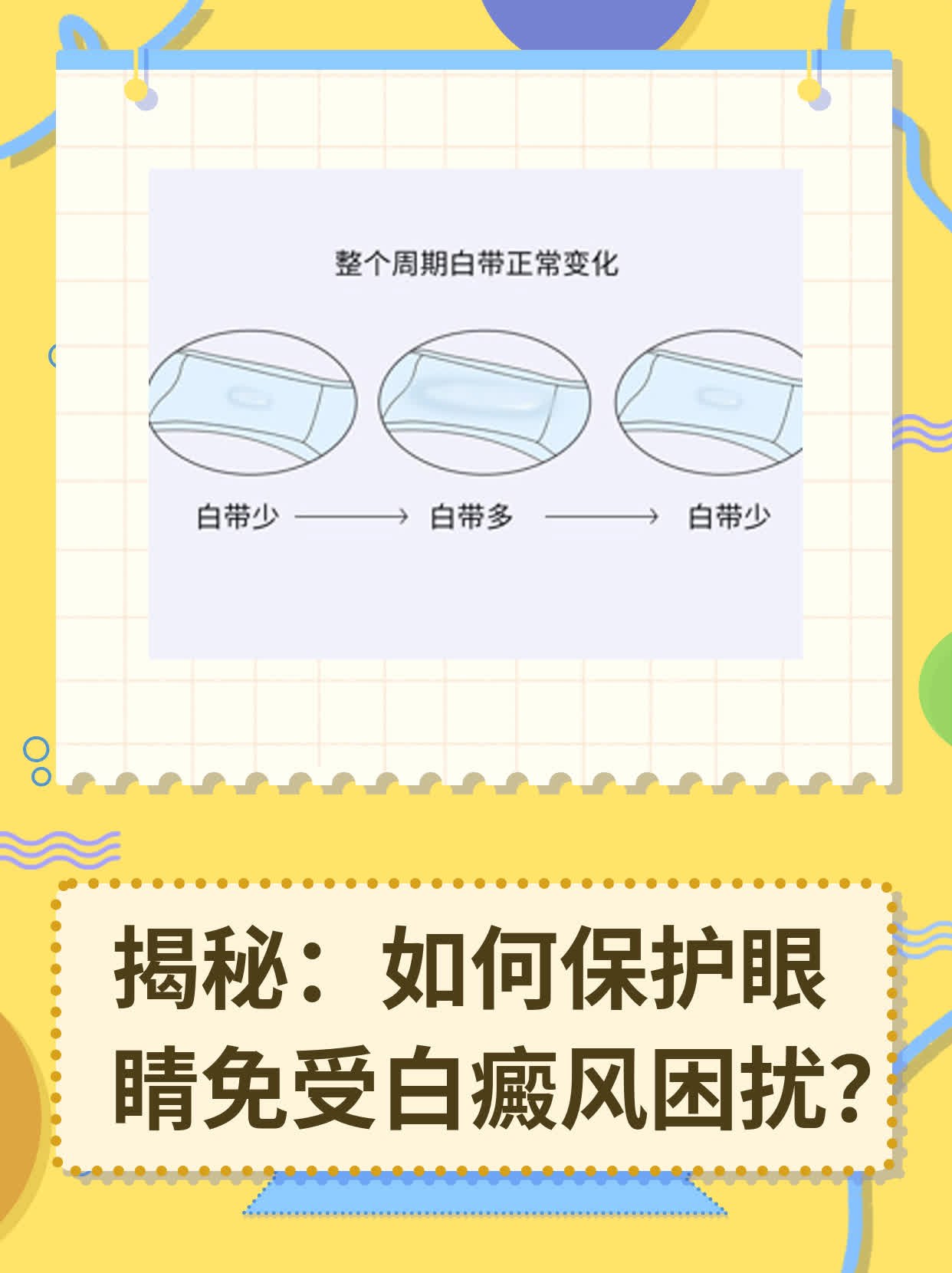 ✅揭秘：如何保护眼睛免受白癜风困扰？💪