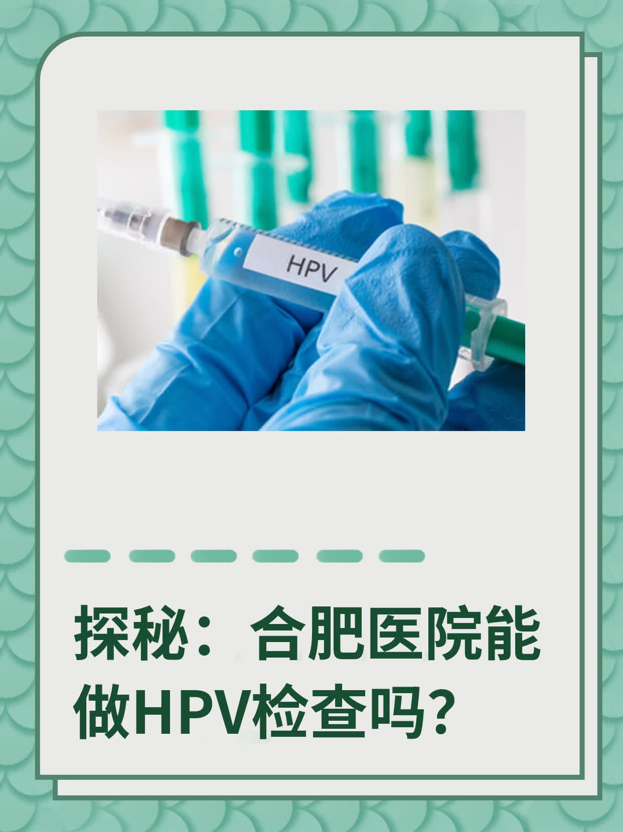 🌟探秘：合肥医院能做HPV检查吗？✨