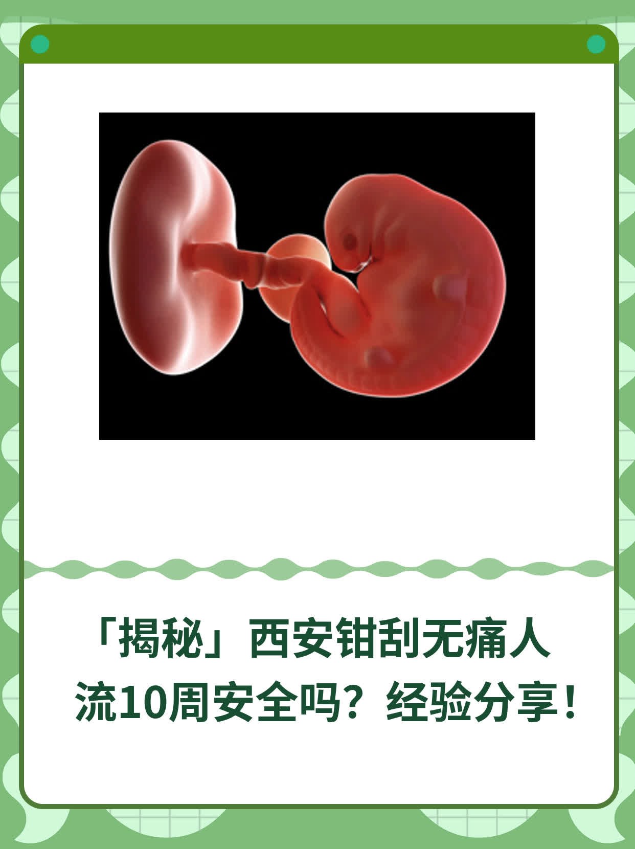 🥦「揭秘」西安钳刮无痛人流10周安全吗？经验分享！🍎