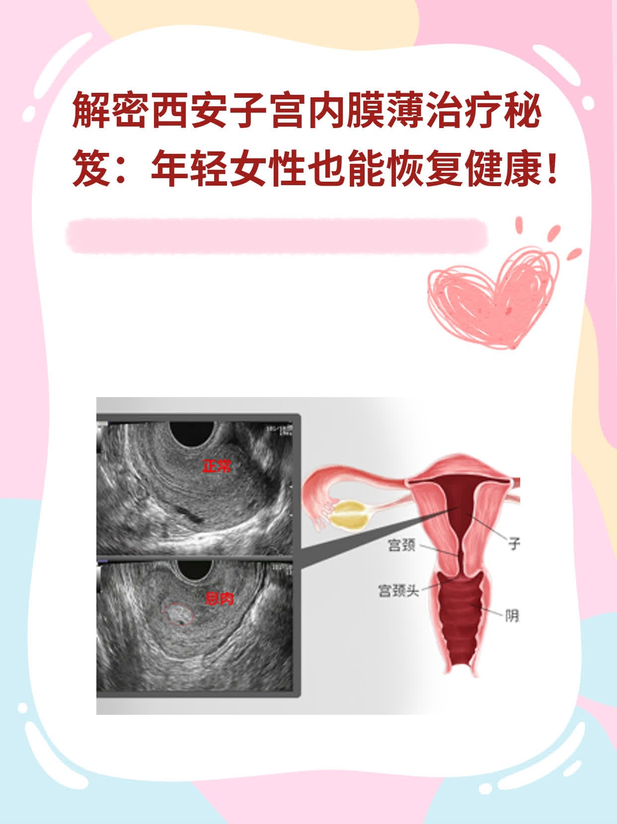 🏃解密西安子宫内膜薄治疗秘笈：年轻女性也能恢复健康！❗️