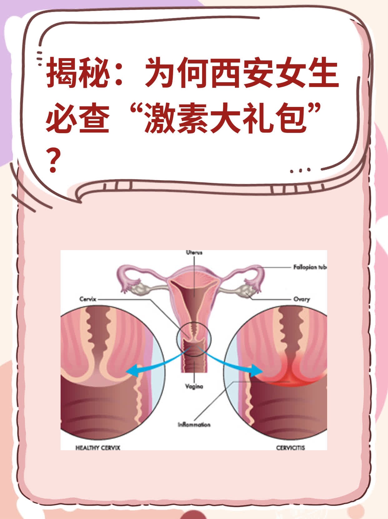 📈揭秘：为何西安女生必查“激素大礼包”？🥊