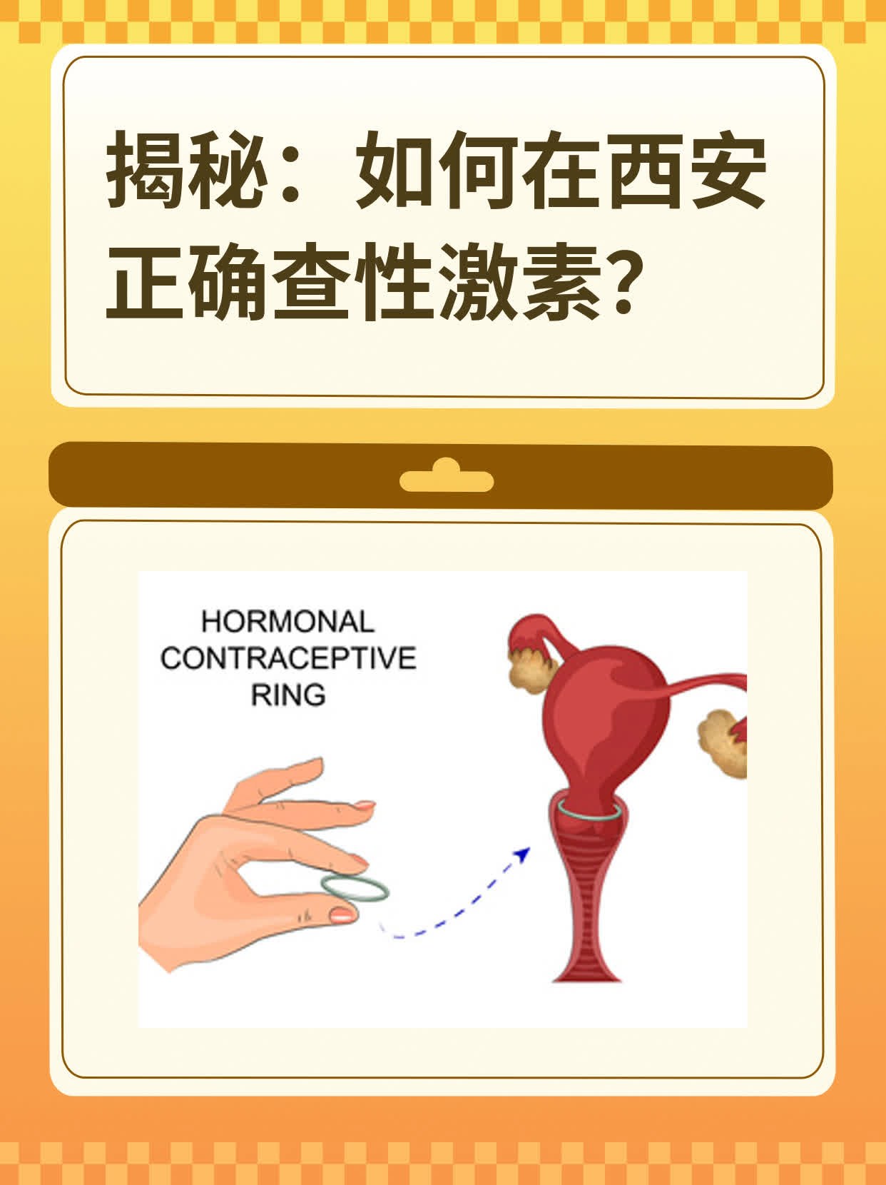 💖揭秘：如何在西安正确查性激素？🙏
