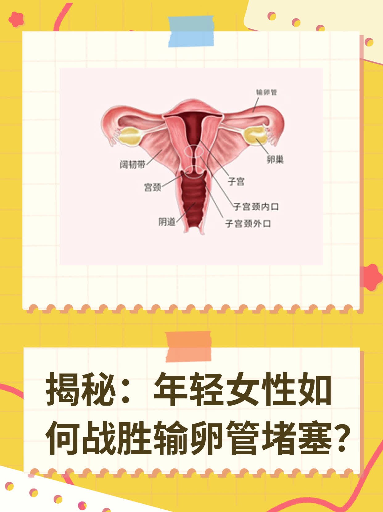 🌟揭秘：年轻女性如何战胜输卵管堵塞？✨