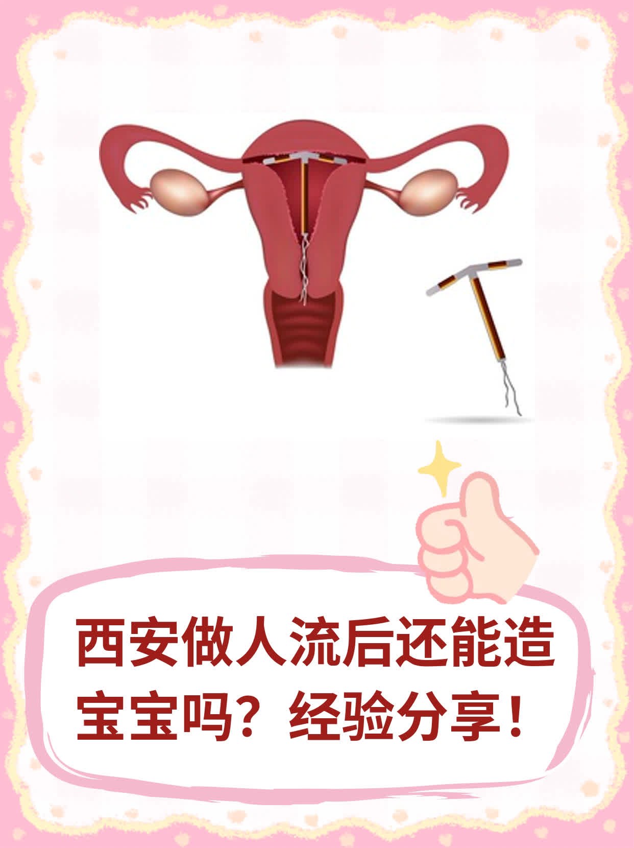 ✅西安做人流后还能造宝宝吗？经验分享！💪