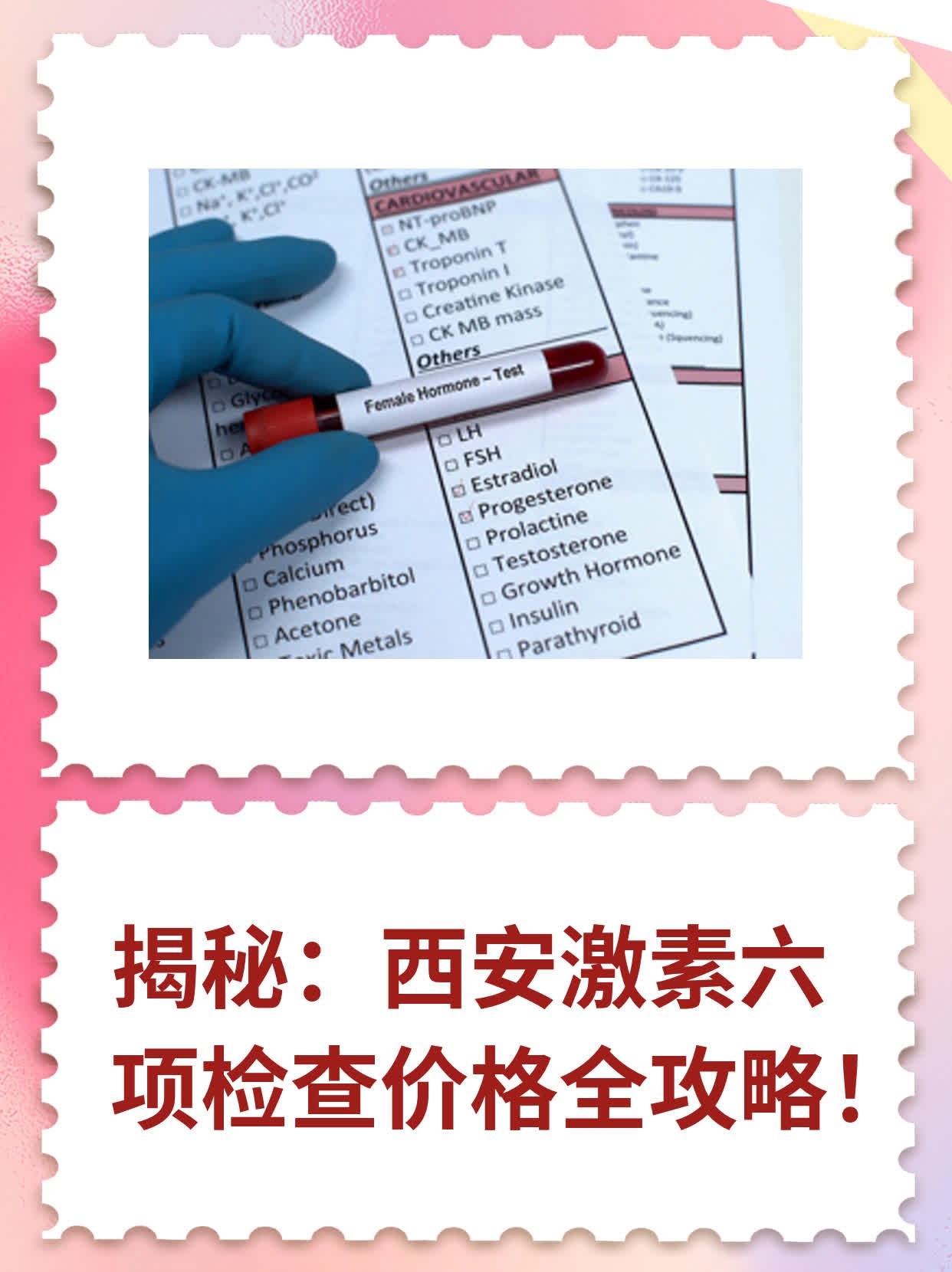 💖揭秘：西安激素六项检查价格全攻略！📈