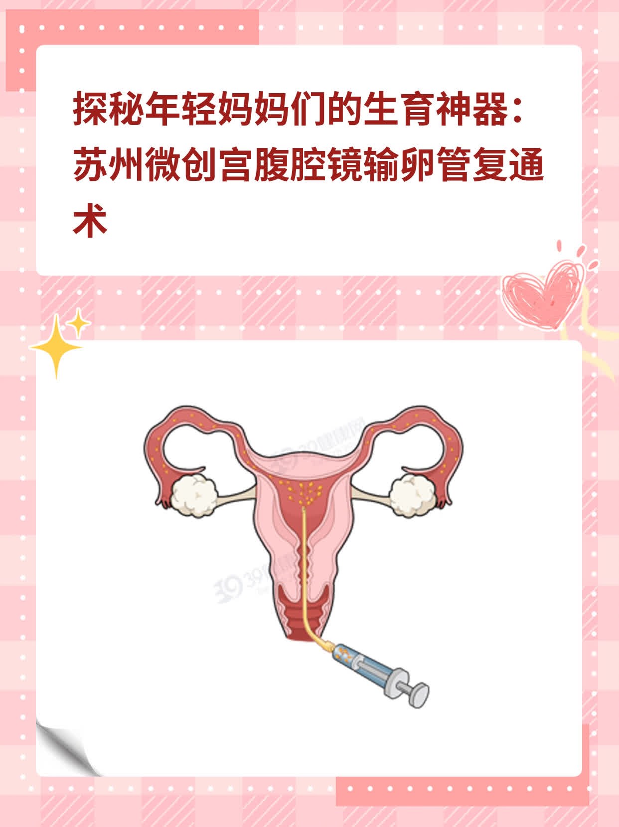 ✨探秘年轻妈妈们的生育神器：苏州微创宫腹腔镜输卵管复通术💖