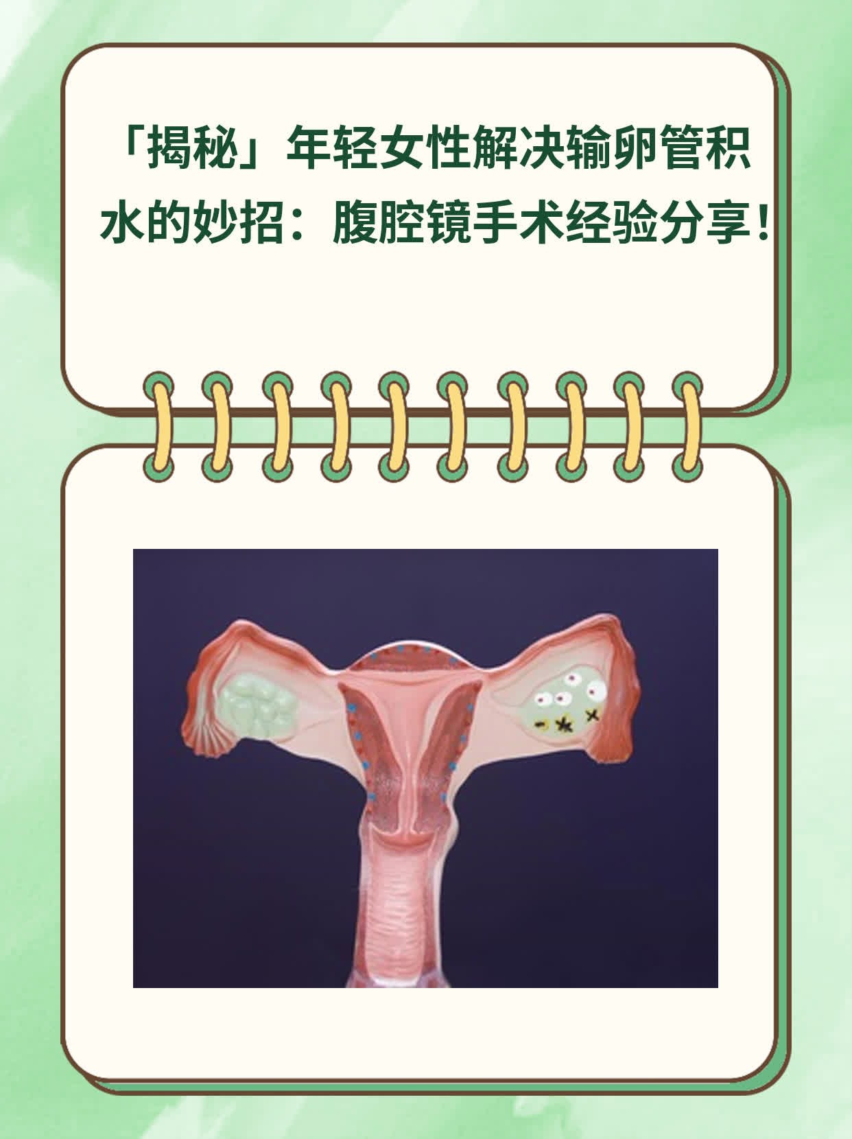 🏃「揭秘」年轻女性解决输卵管积水的妙招：腹腔镜手术经验分享！❗️