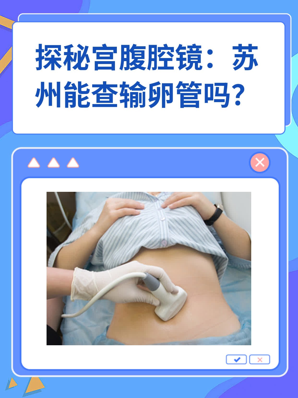 🌟探秘宫腹腔镜：苏州能查输卵管吗？✨