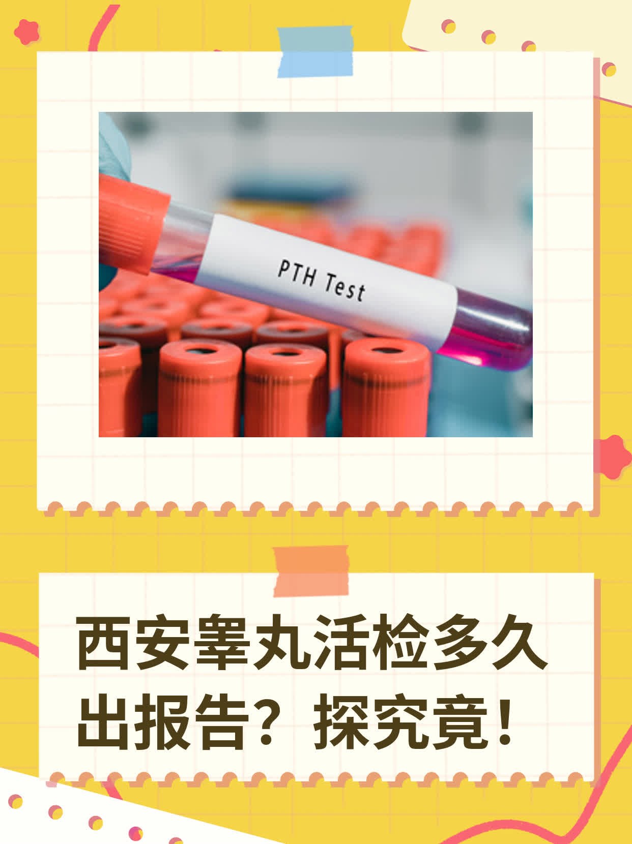 💊西安睾丸活检多久出报告？探究竟！👍