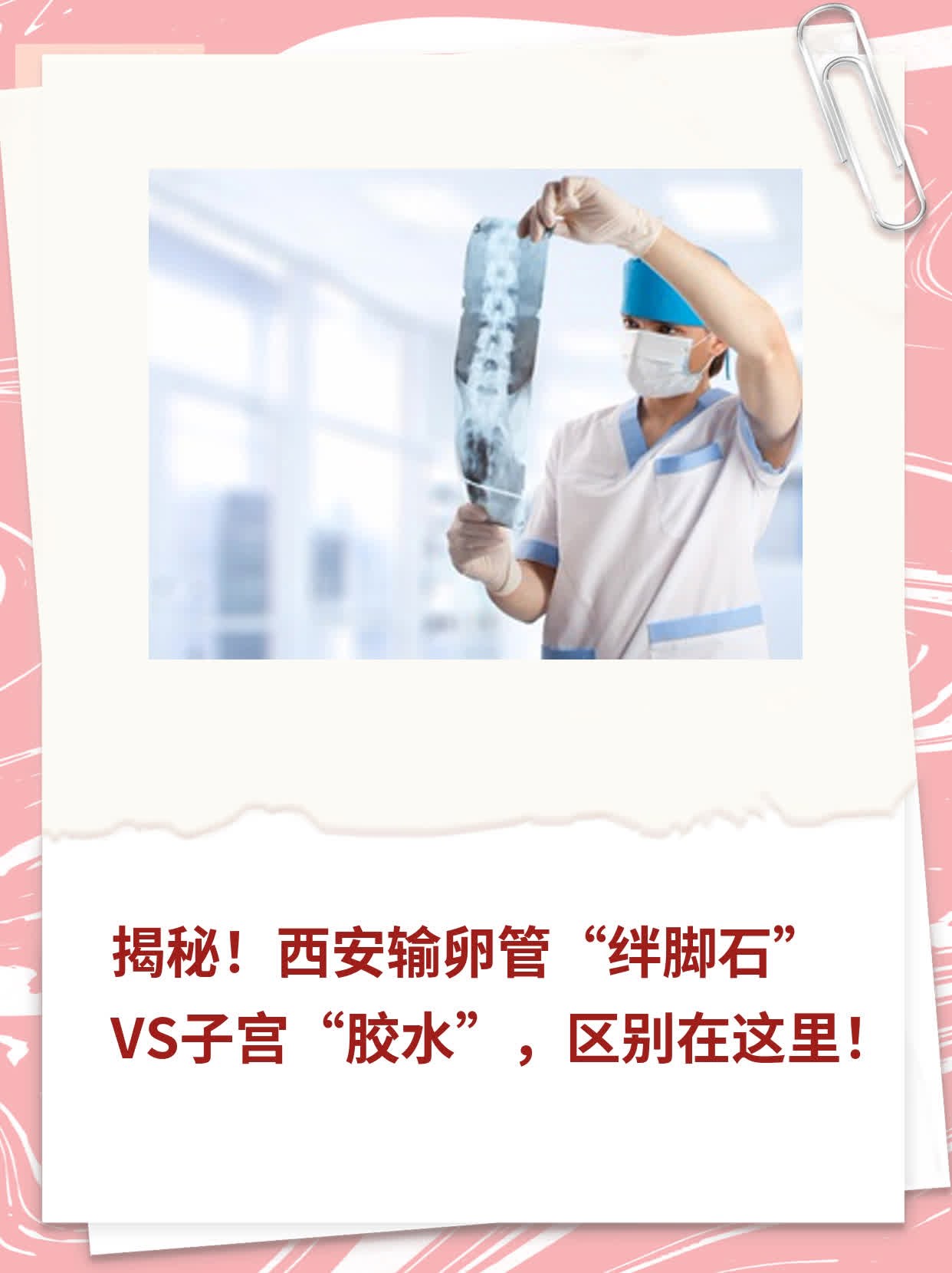 🌟揭秘！西安输卵管“绊脚石”VS子宫“胶水”，区别在这里！✨