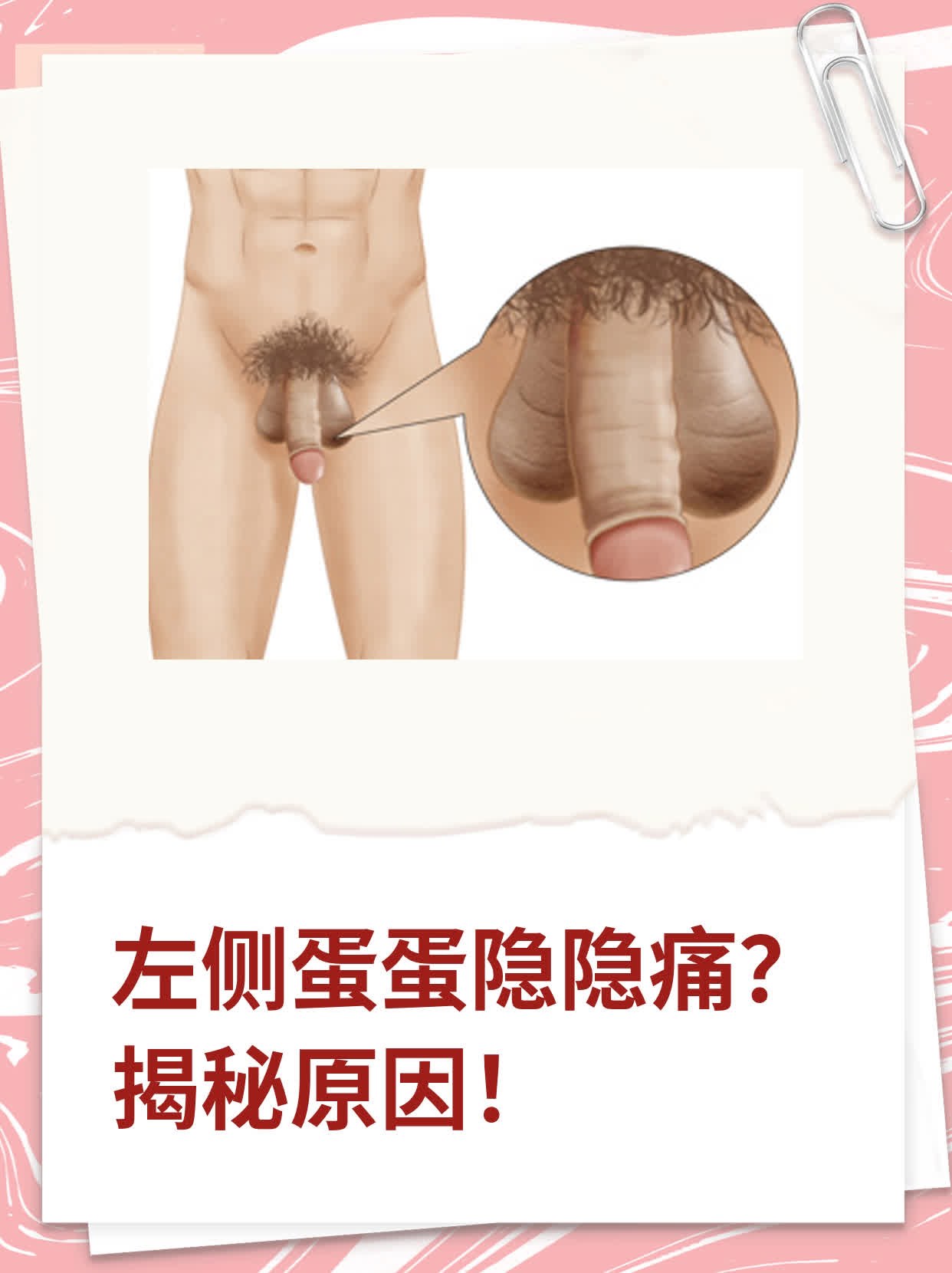 💊左侧蛋蛋隐隐痛？揭秘原因！👍