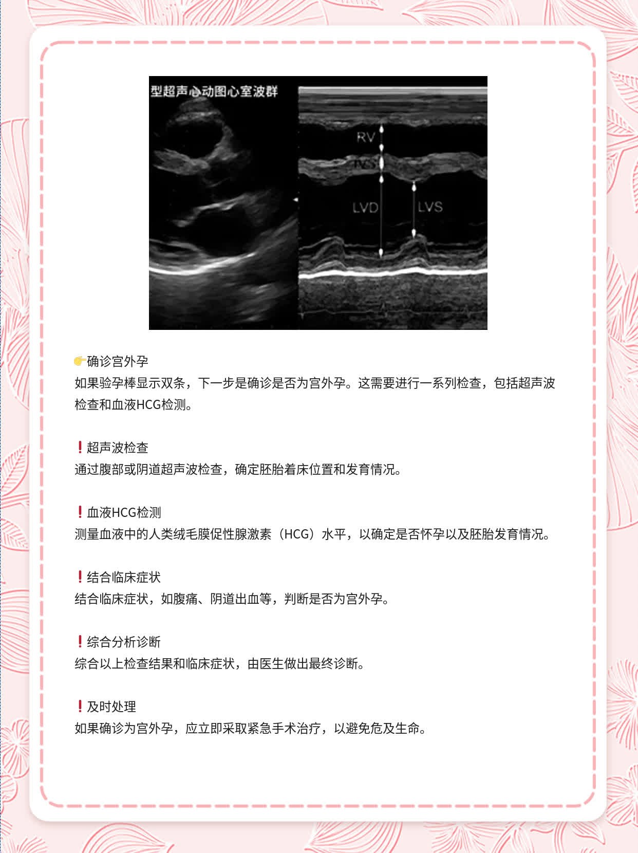 👍验孕棒双条？这可能是你怀孕的信号！🛏️