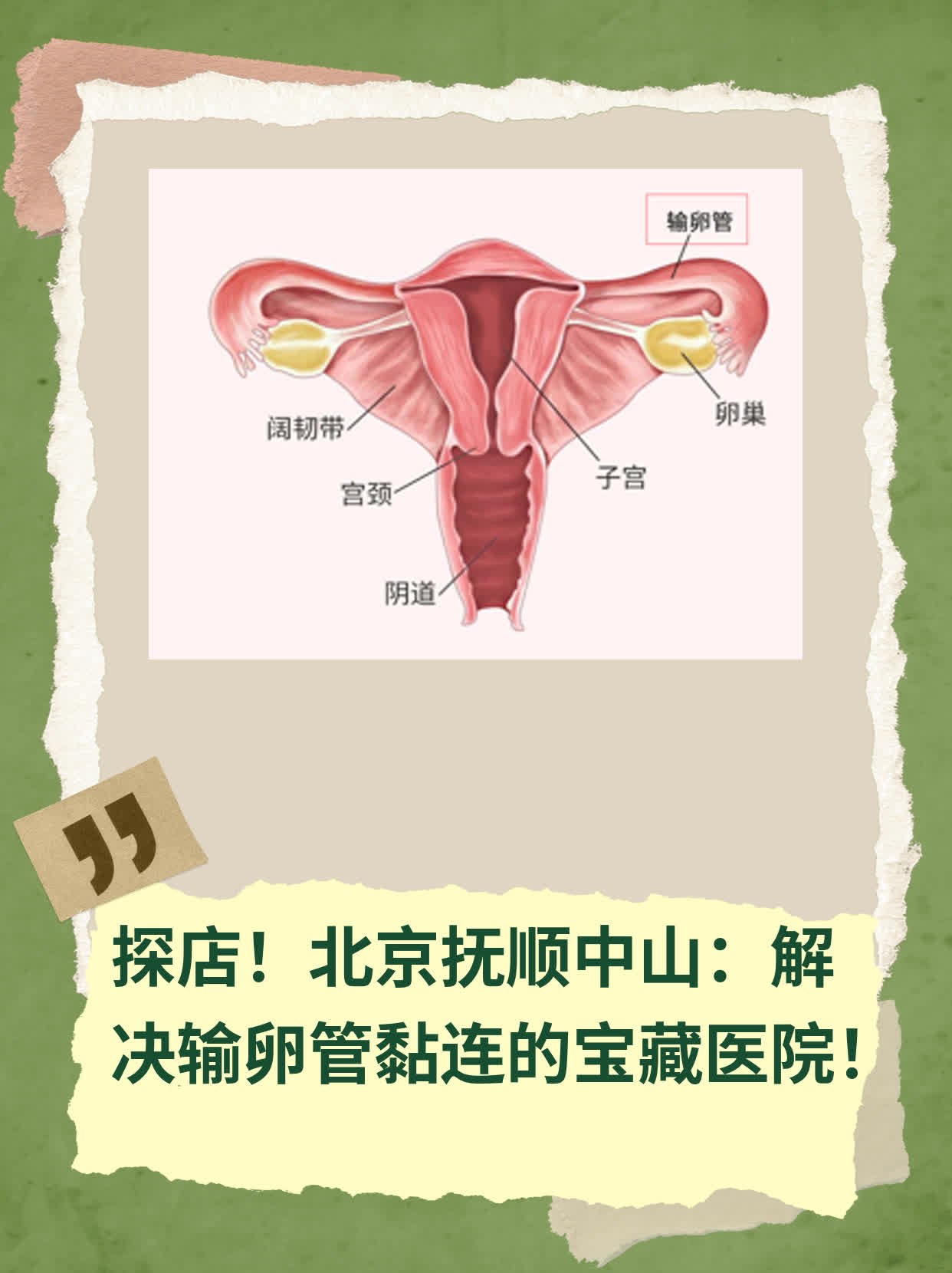 ❗️探店！北京抚顺中山：解决输卵管黏连的宝藏医院！✅