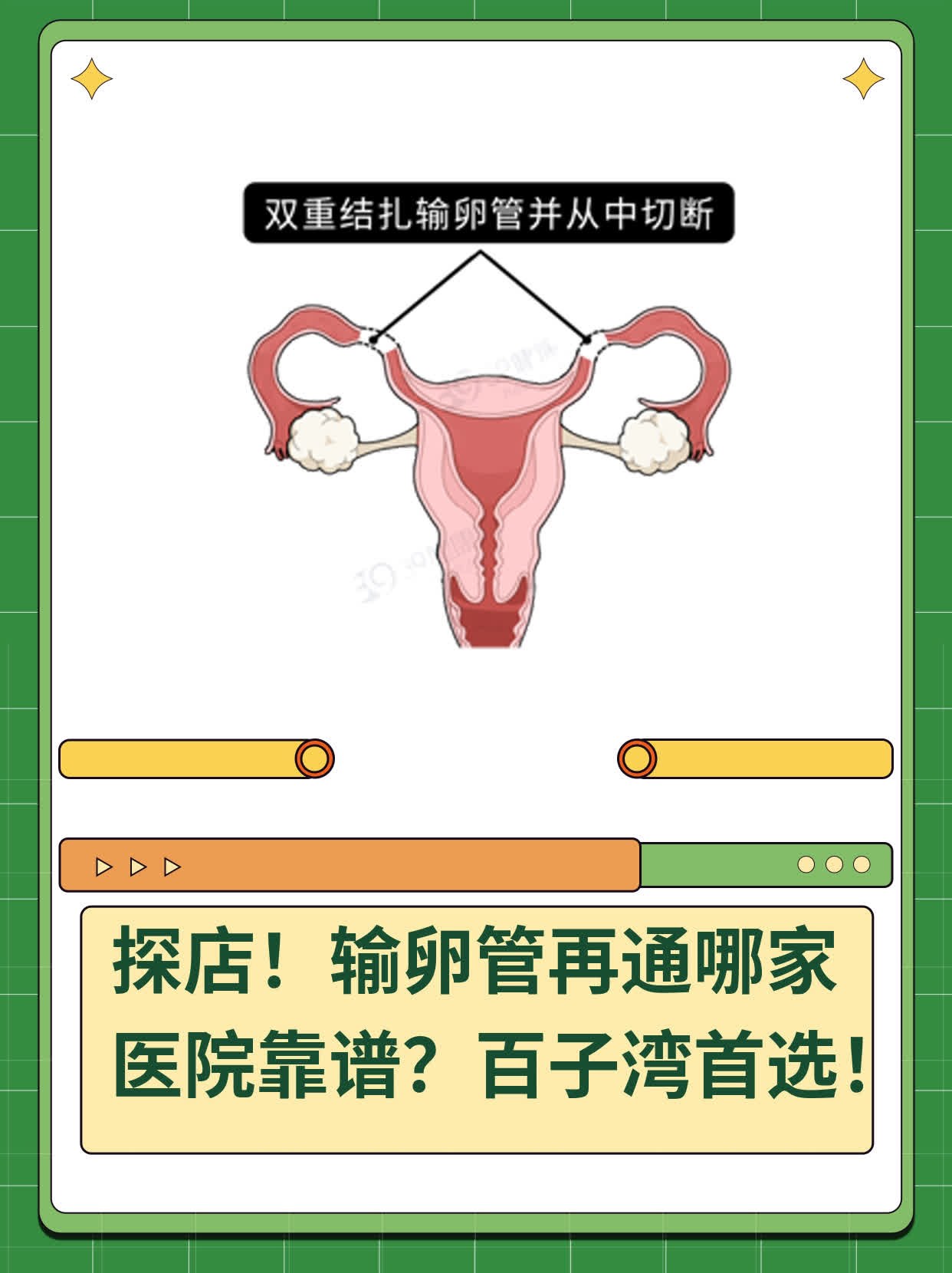🥊探店！输卵管再通哪家医院靠谱？百子湾首选！🥩