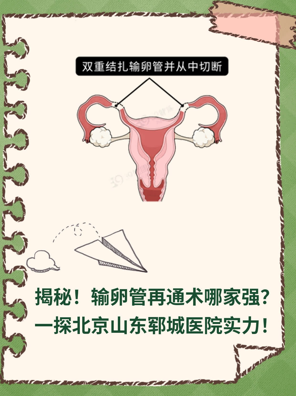 ✅揭秘！输卵管再通术哪家强？一探北京山东郓城医院实力！💪