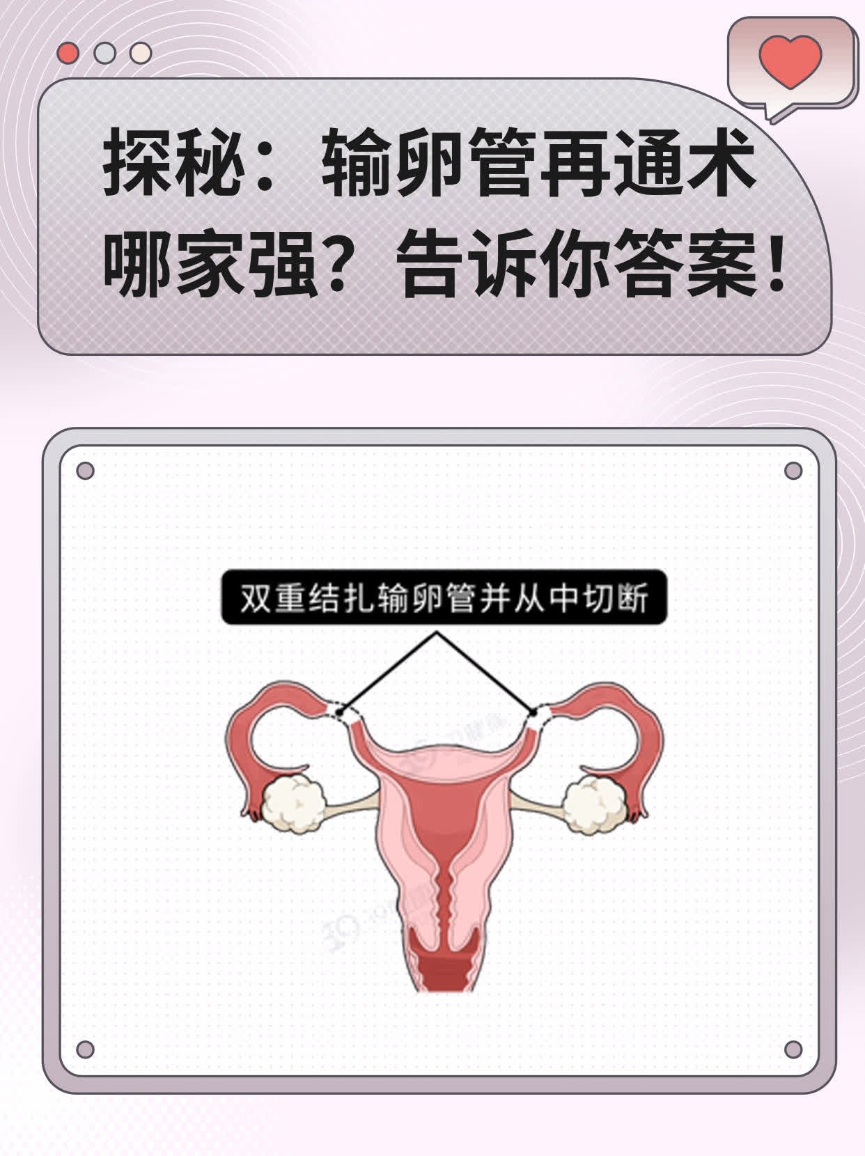 💖探秘：输卵管再通术哪家强？告诉你答案！🙏