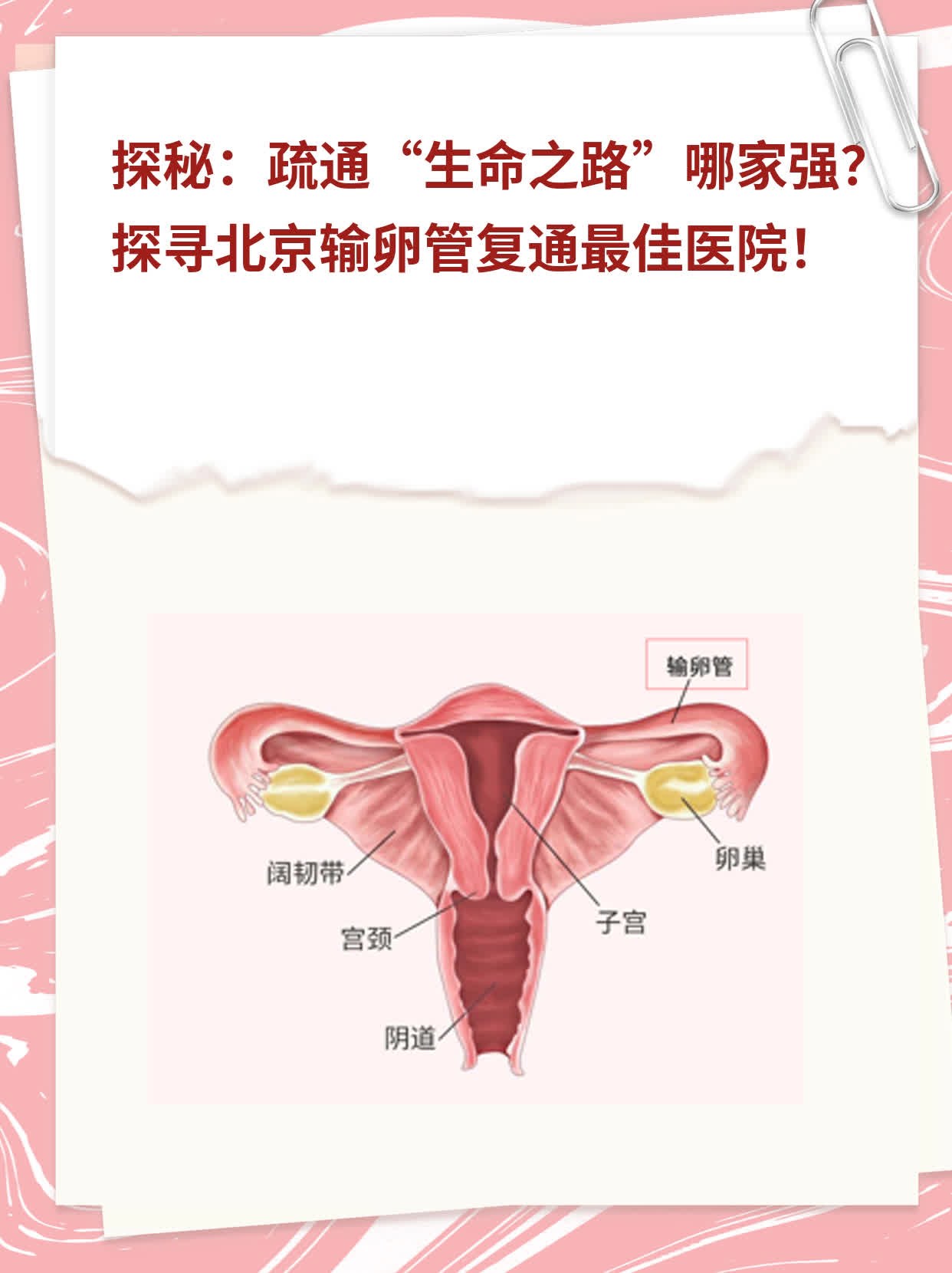 💖探秘：疏通“生命之路”哪家强？探寻北京输卵管复通最佳医院！📈