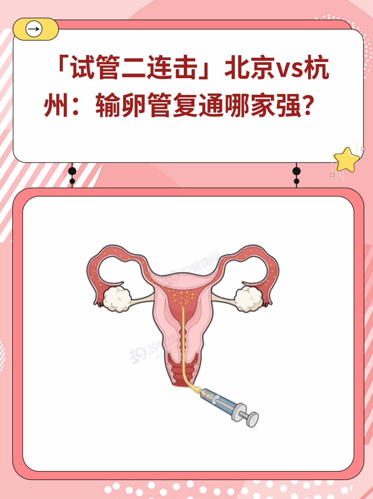 🥊「试管二连击」北京vs杭州：输卵管复通哪家强？🥩