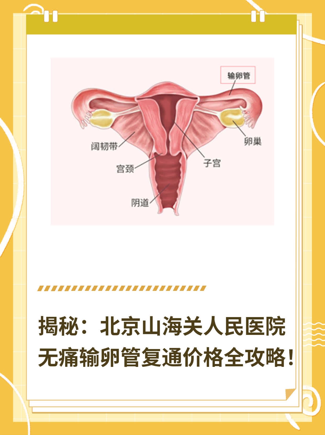 💪揭秘：北京山海关人民医院无痛输卵管复通价格全攻略！💖