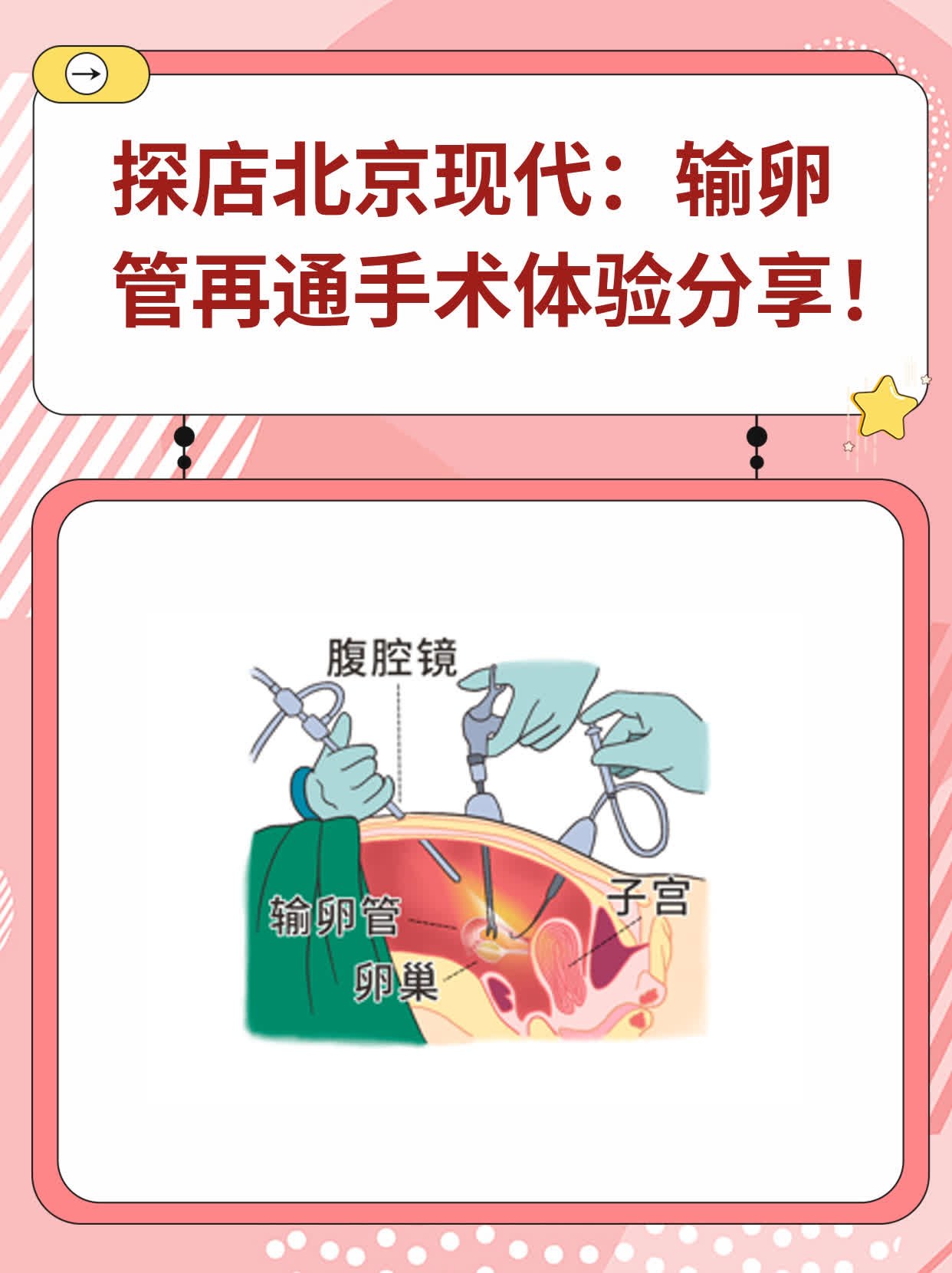 👍探店北京现代：输卵管再通手术体验分享！🛏️
