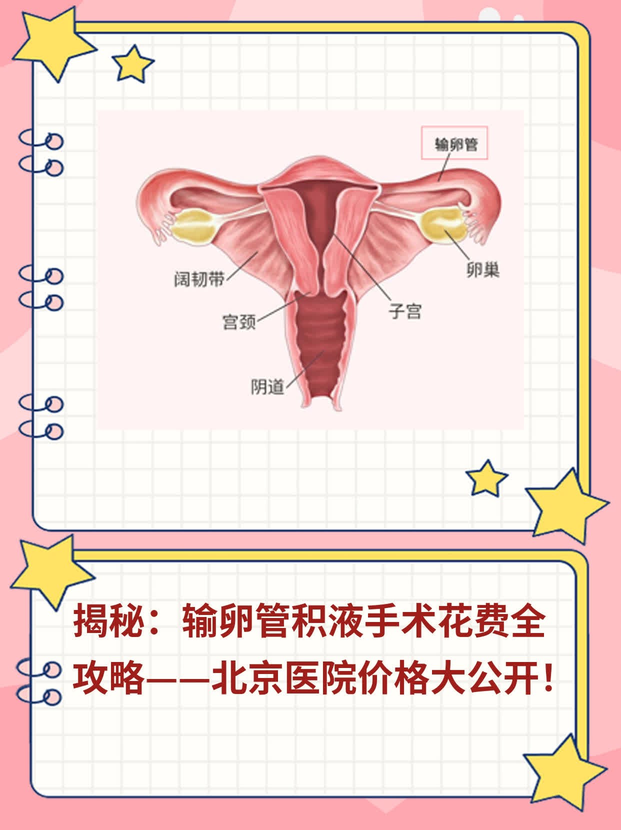 📈揭秘：输卵管积液手术花费全攻略——北京医院价格大公开！🥊