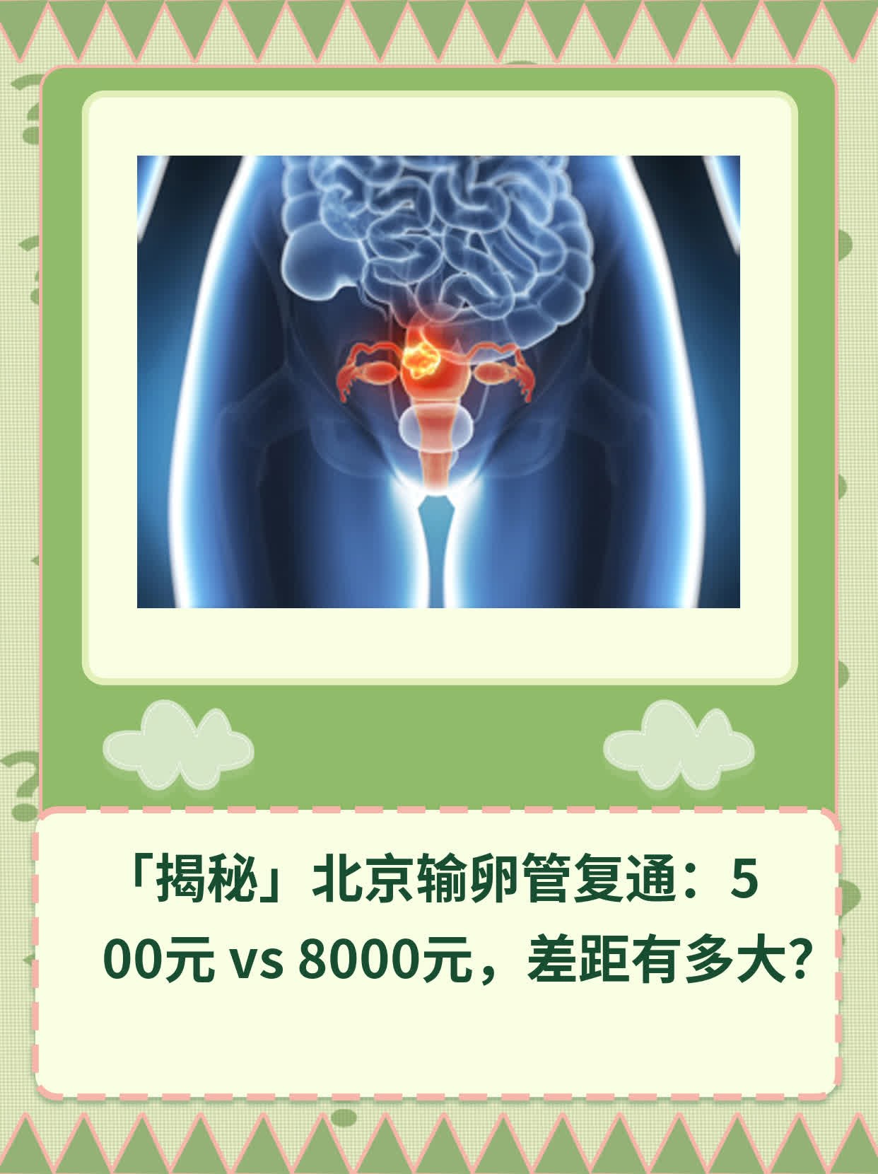 🙏「揭秘」北京输卵管复通：500元 vs 8000元，差距有多大？💊