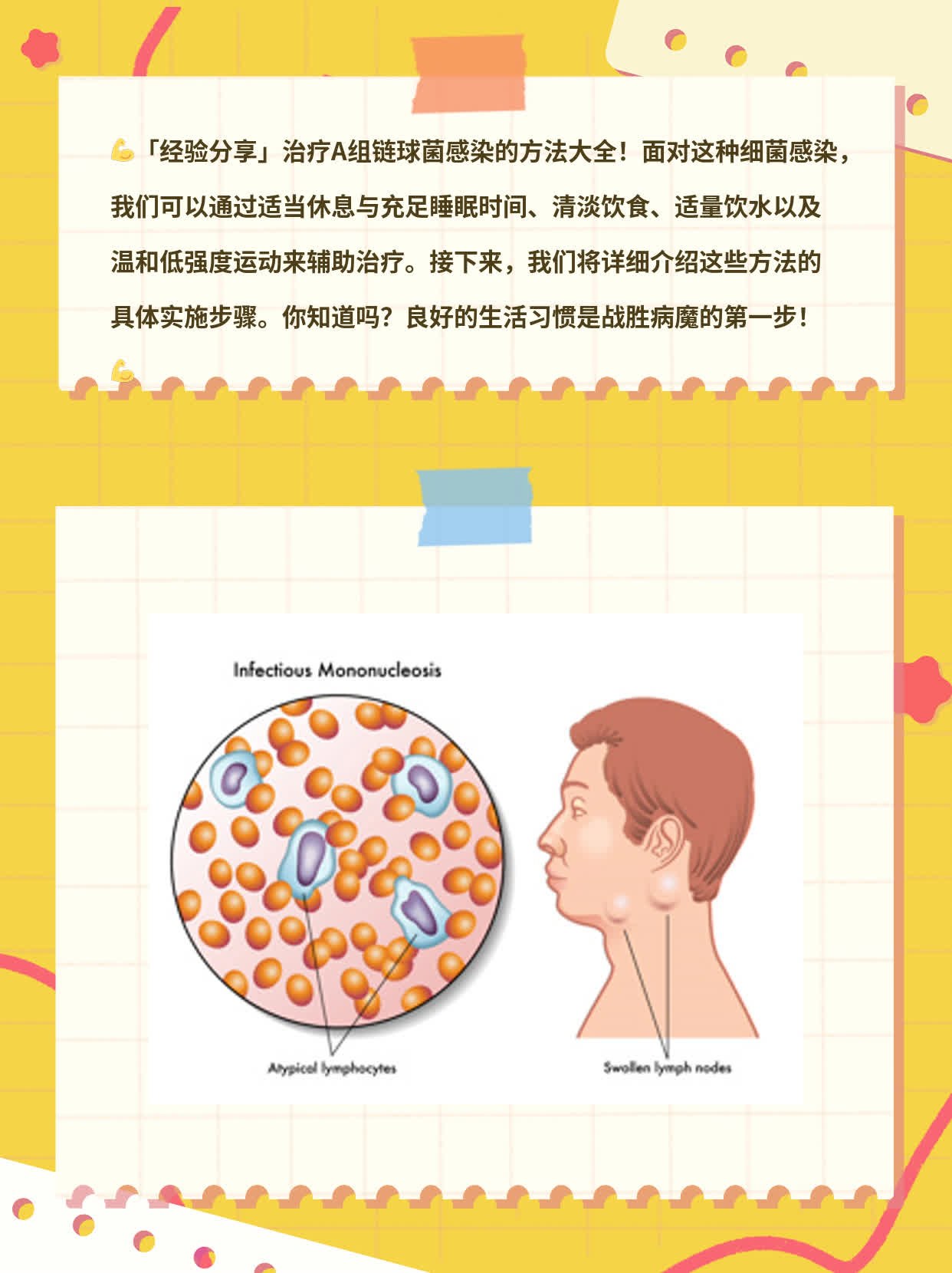 「经验分享」治疗 A 组链球菌感染的方法大全