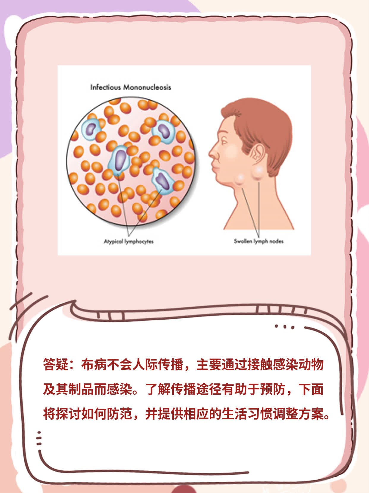 「答疑」布病是否会人际传播及方式探析