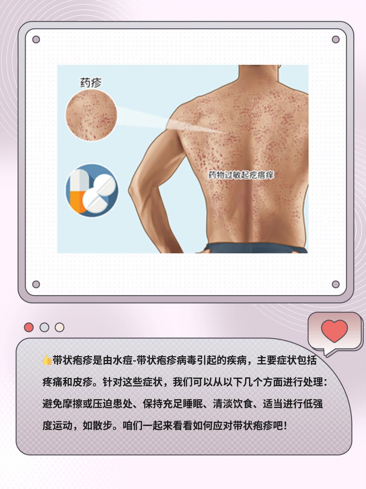 「看图识病」带状疱疹症状大盘点